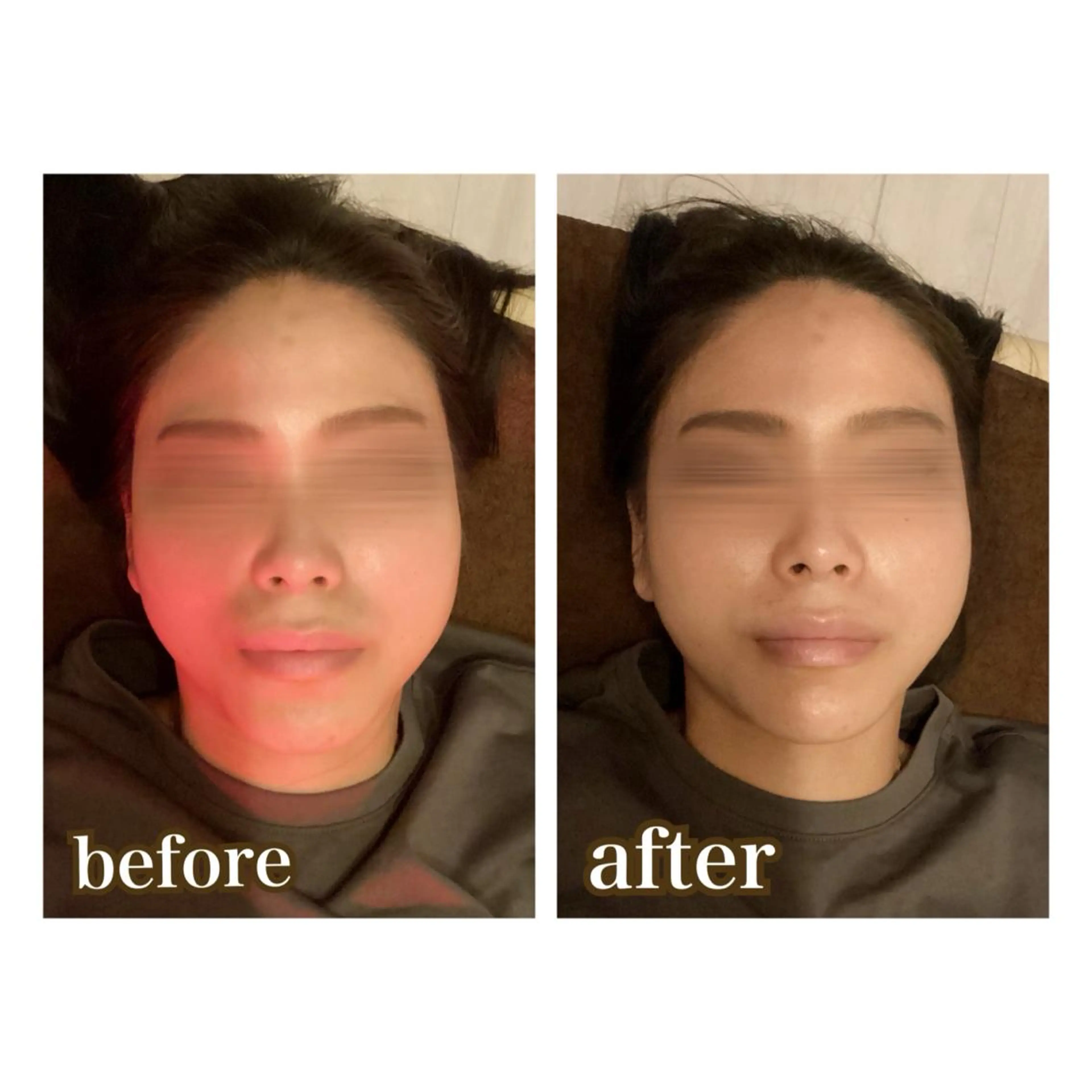 美腸専門 漢方よもぎ蒸しのエステ・リラクイメージ