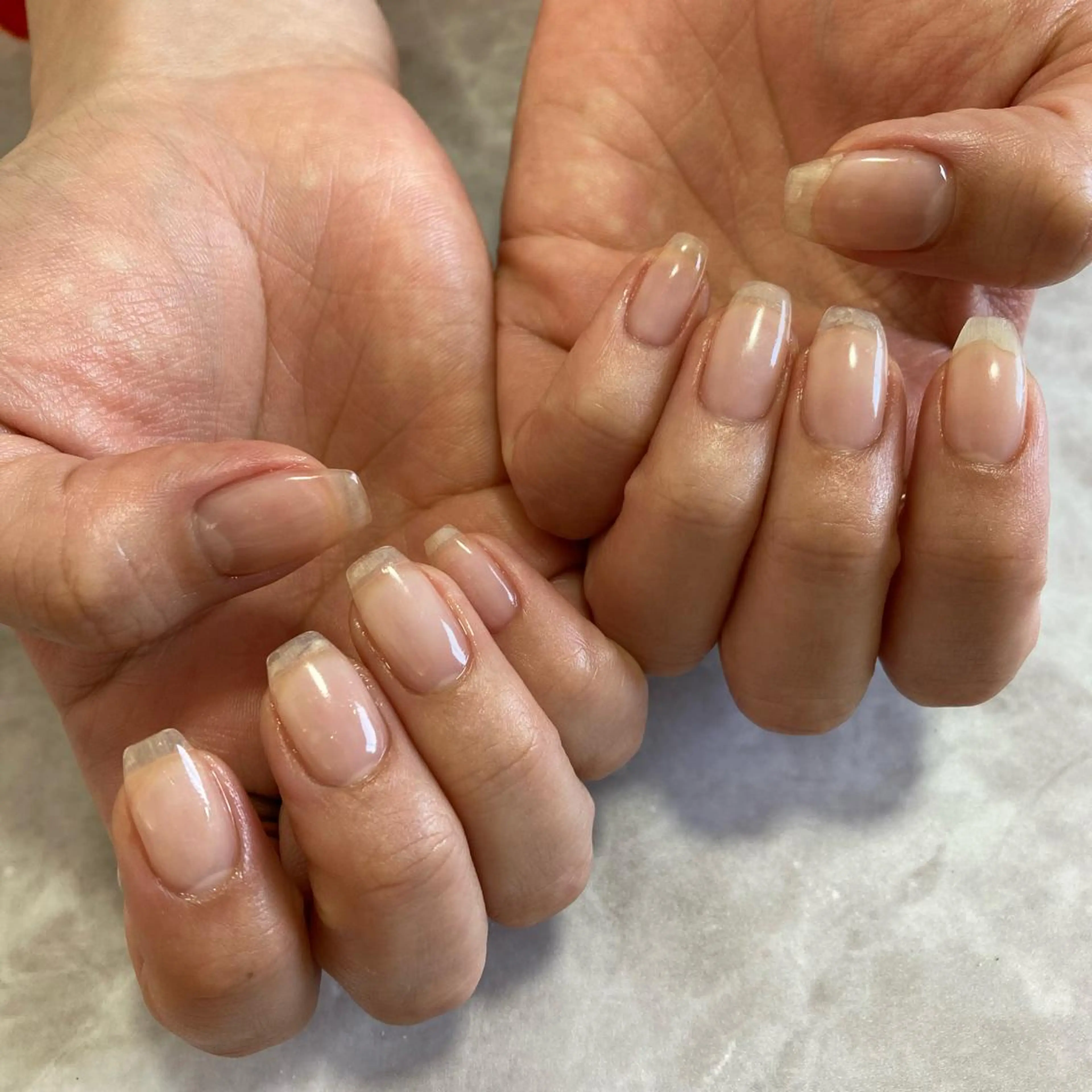 クリアジェル　フィルイン込の写真