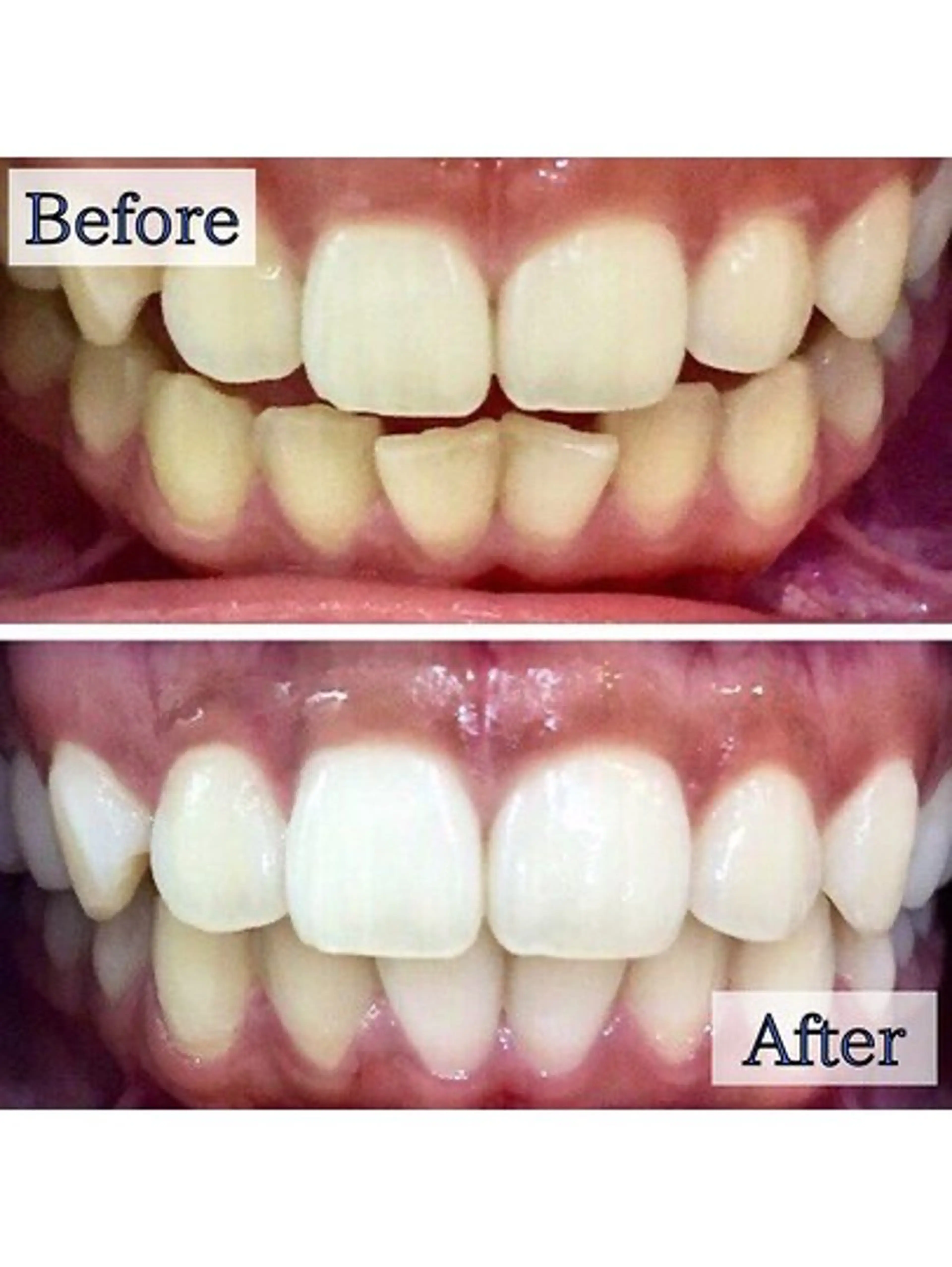 エステ リラク LBSホワイトニング上野店所属・LBSホワイトニング 🌐 上野店公式のエステ・リラクイメージ