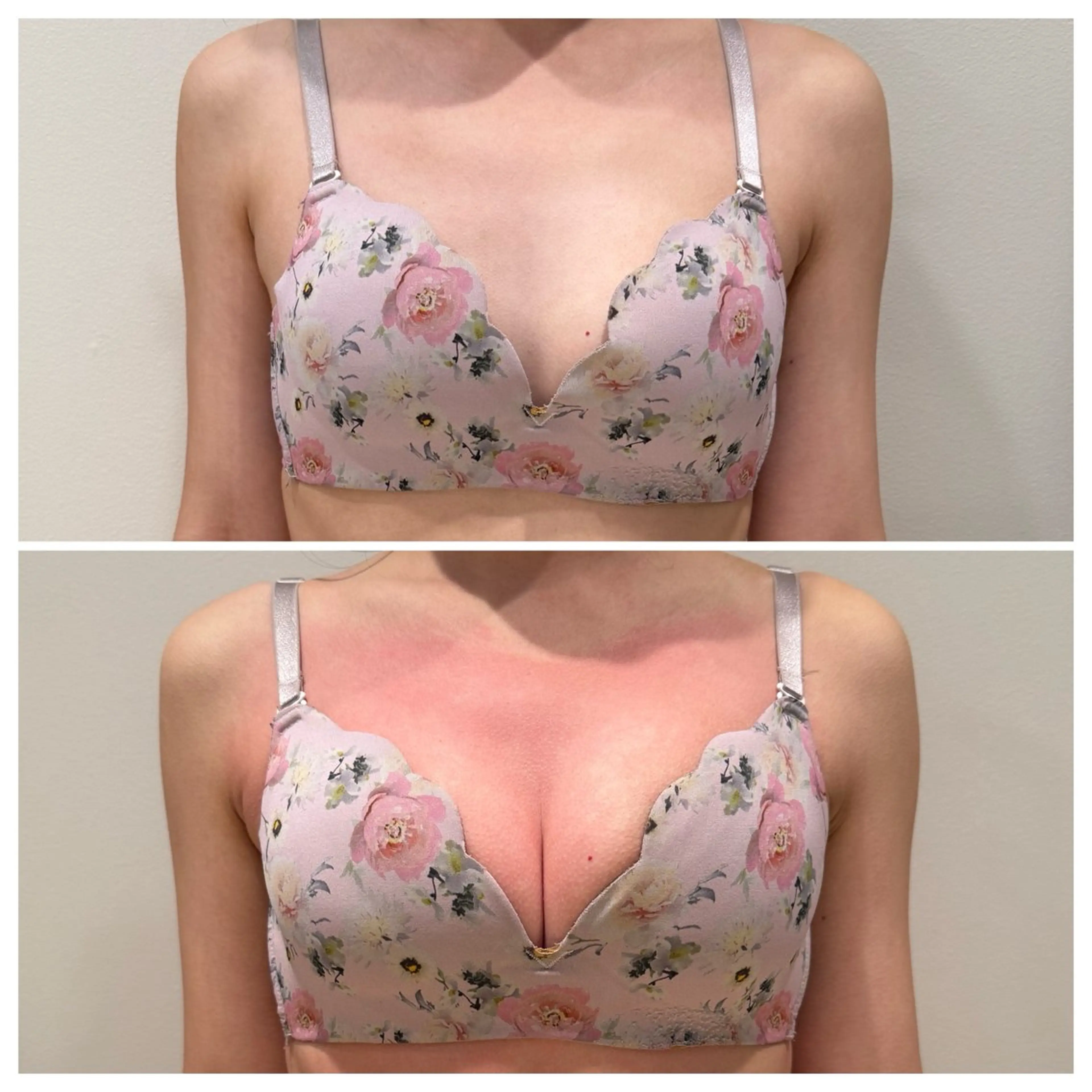 エステ beautysalon RAVIS所属・東大阪/韓国肌管理/ 痩身バスト専門店のエステ・リラクイメージ