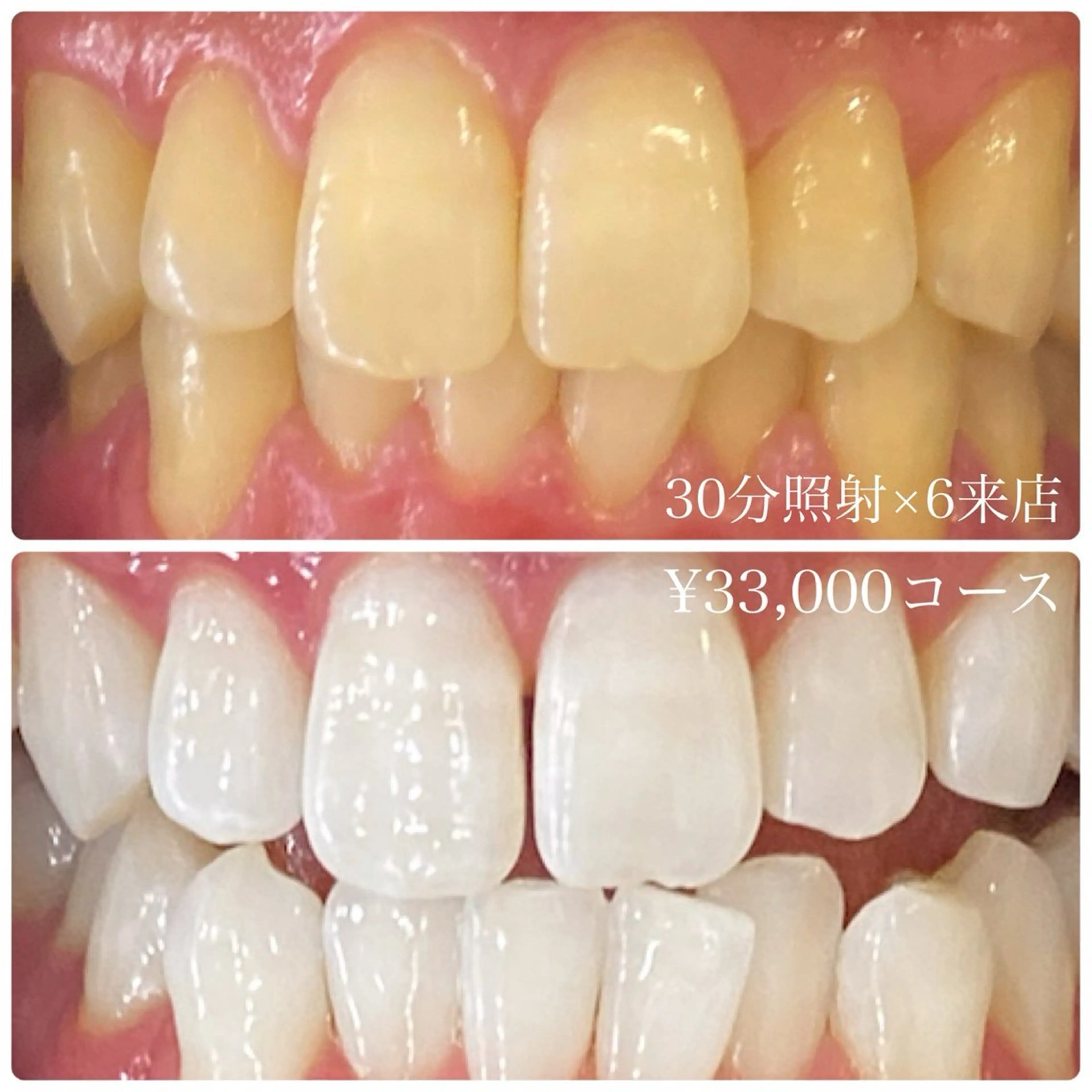 その他 PLATINUM Beauty 横浜店所属・ホワイトニングルーム 横浜店のその他イメージ