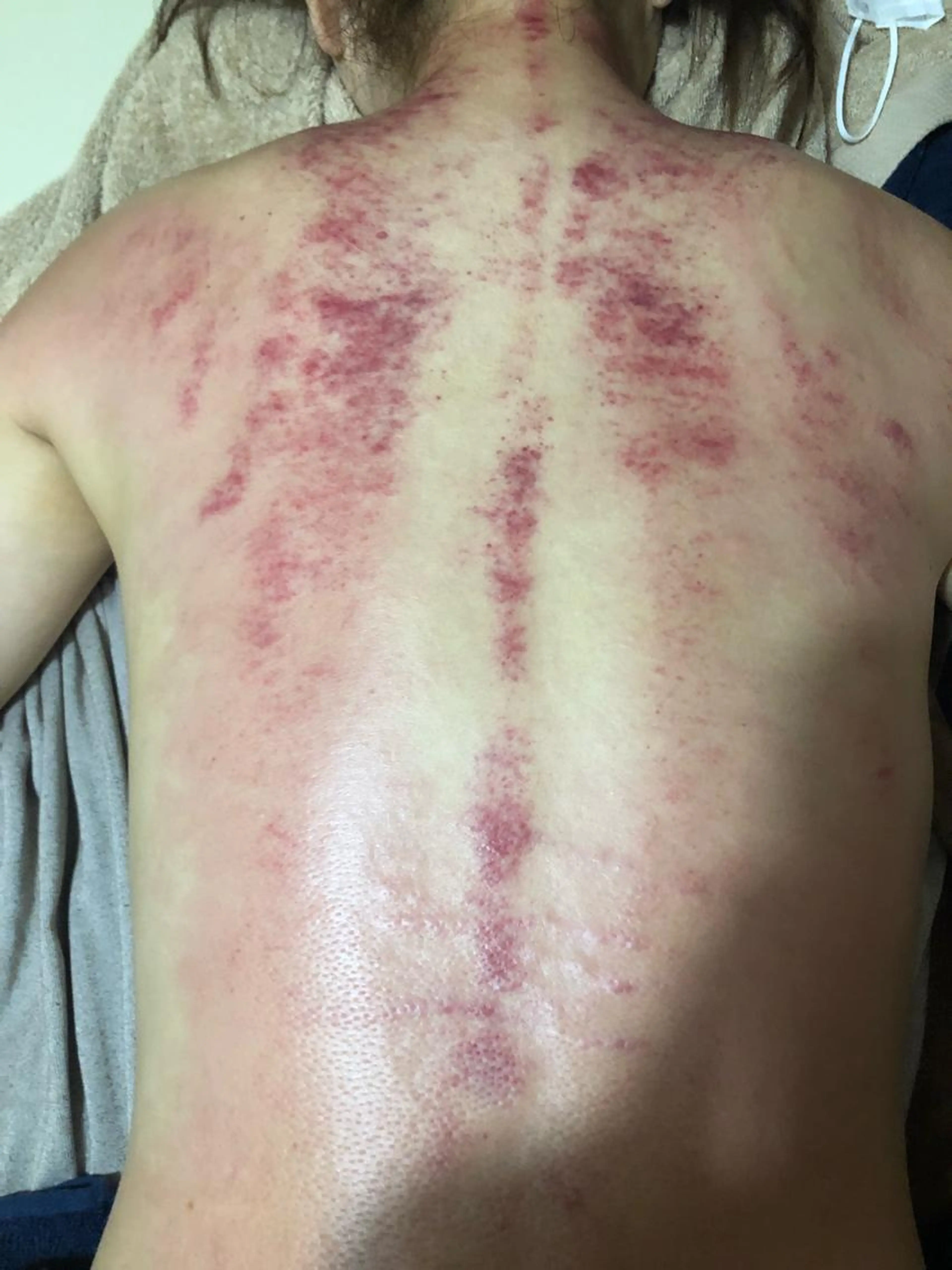 かっさ全身（頭、肩、腕、背中、足）コース。漢方アロマオイルを使ってかっさをしていきます。の写真