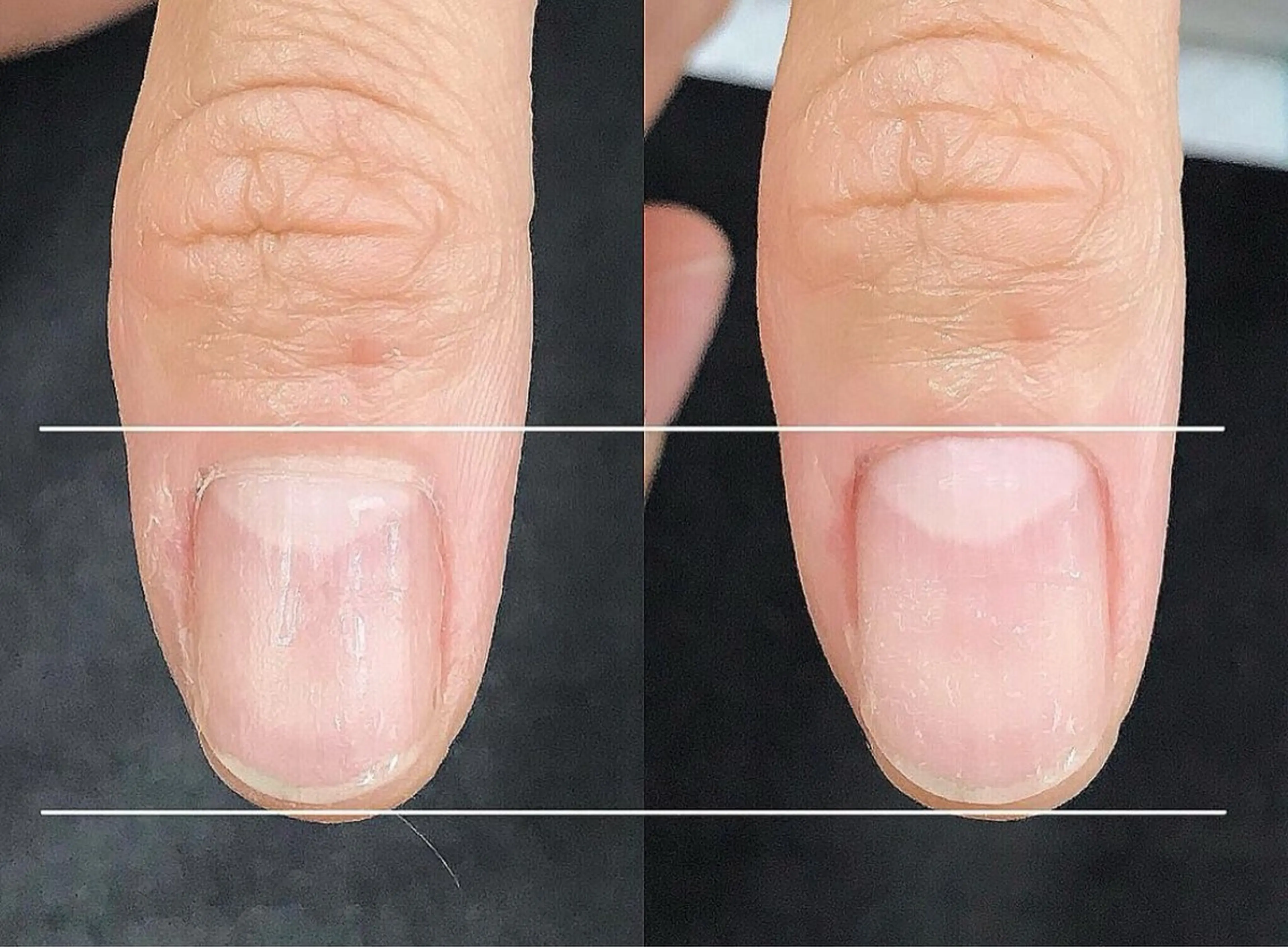 ネイル ネイルリボン 笠井のネイルデザイン