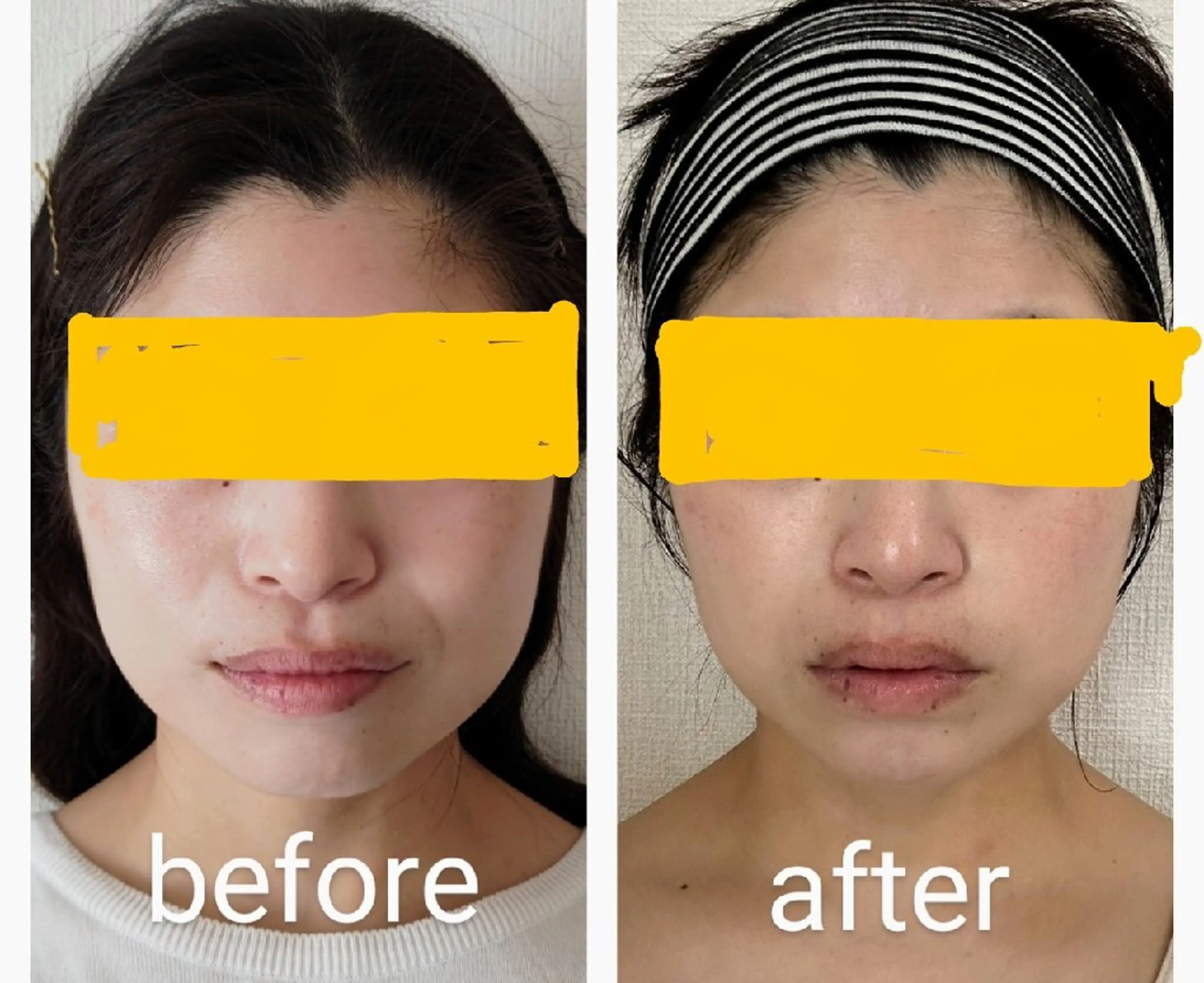 小顔矯正夙川 カレーズのエステ・リラクイメージ