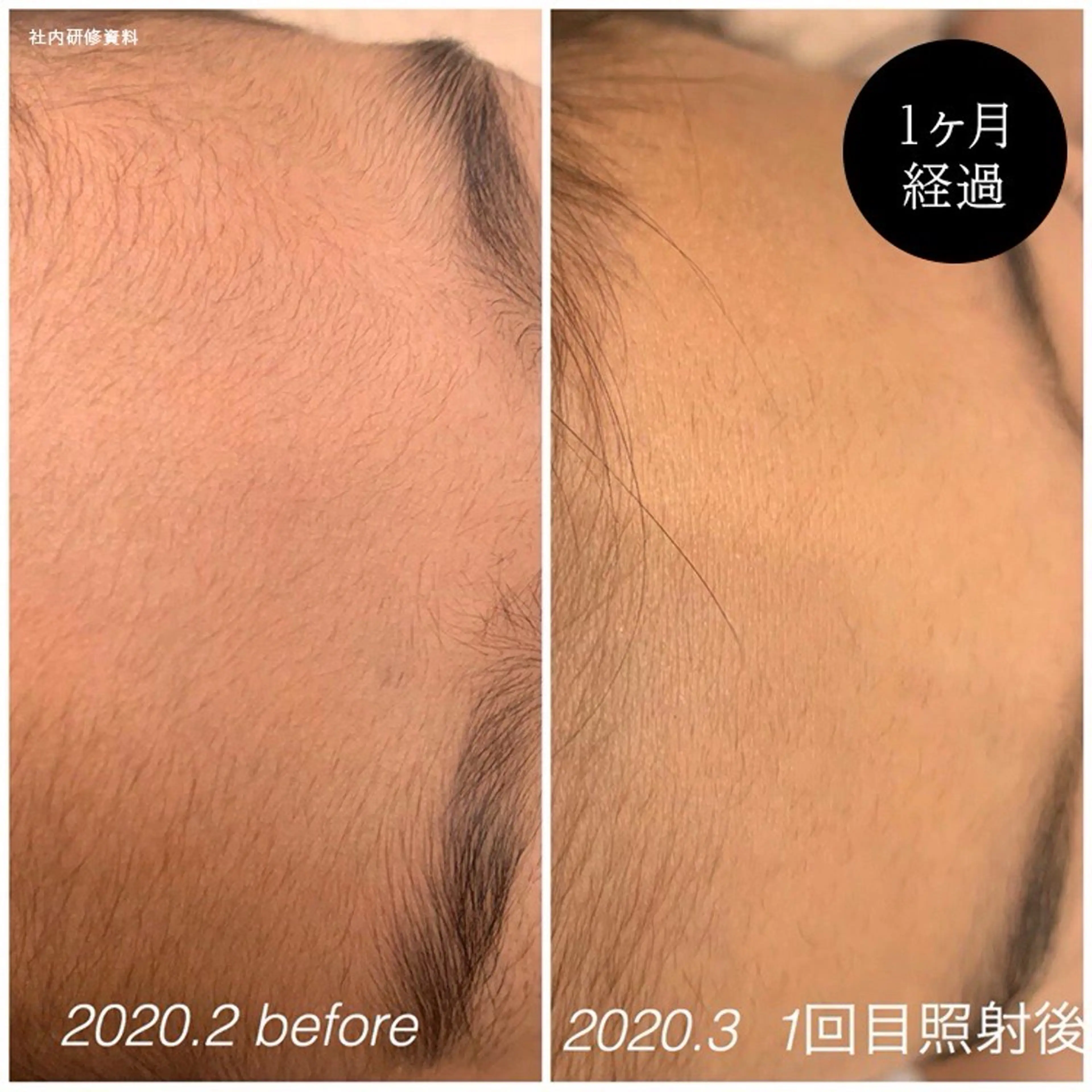 キッズ 脱毛 A/S アズのエステ・リラクイメージ