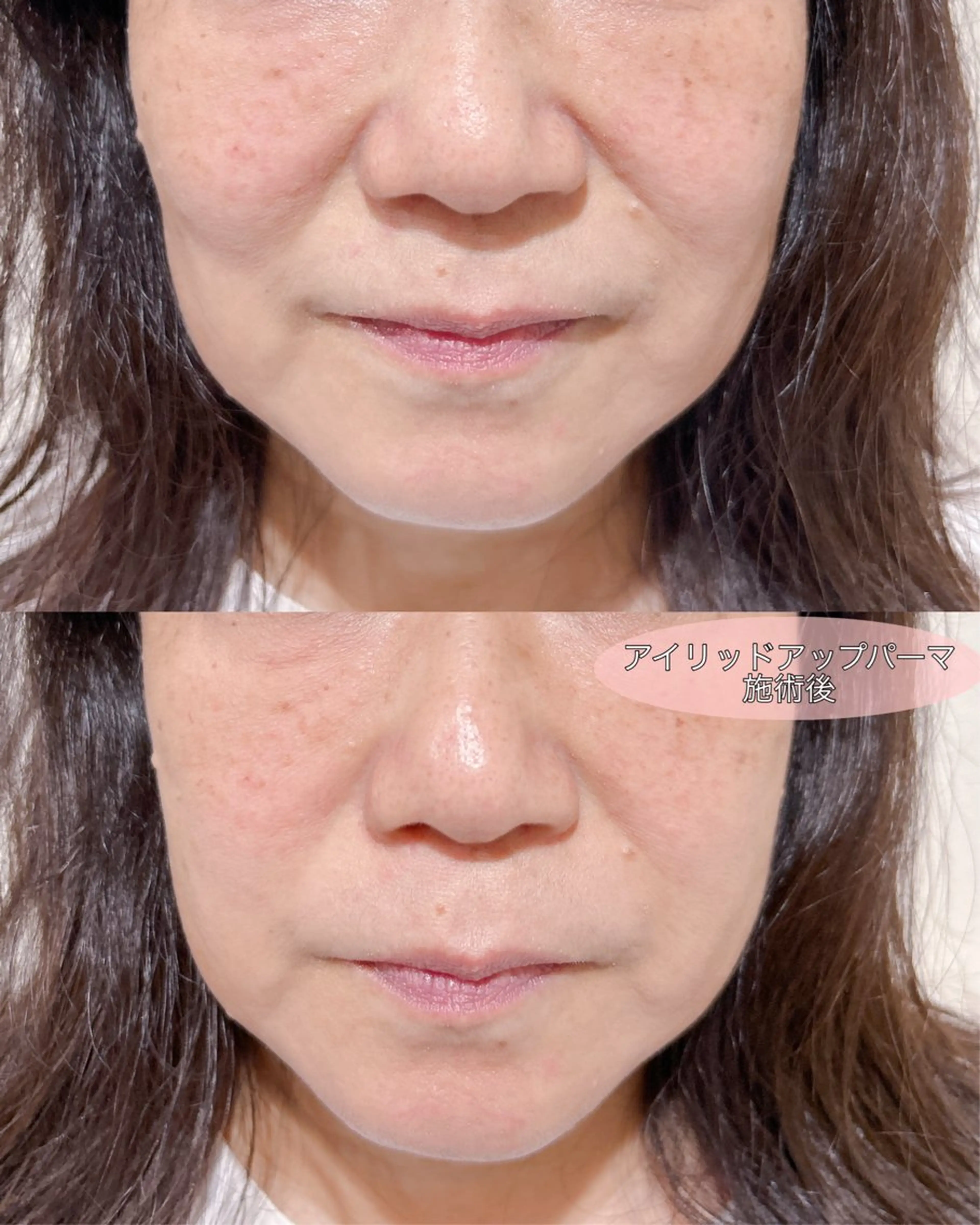 マツエク・マツパ アイリッドアップパーマ 一重×まつ毛パーマ マツパ merveilles所属・まつげ/整体/にきび ・アトピー専門サロンのマツエク・マツパデザイン