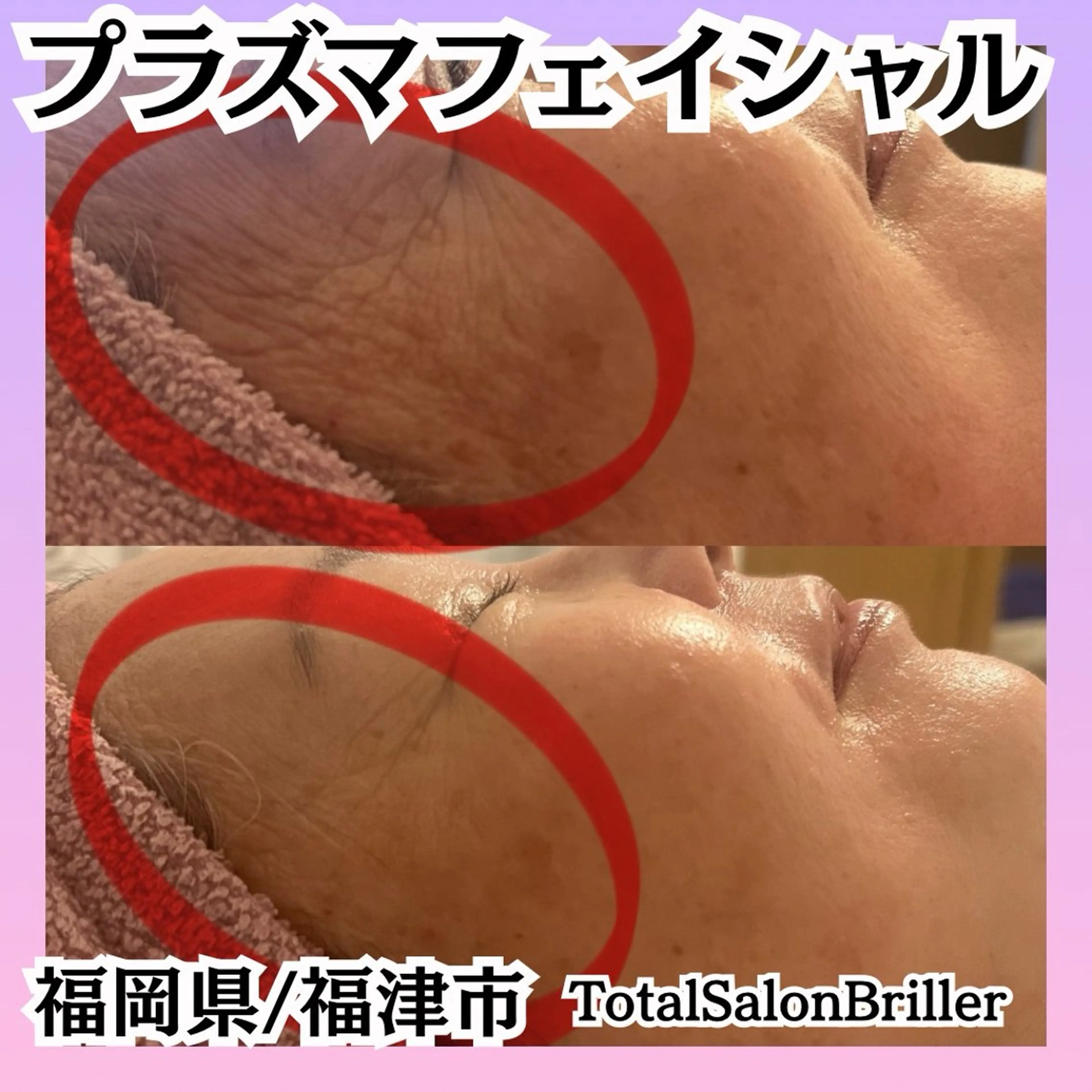 TotalSalon Briller所属・Nakashita Sayakaのエステ・リラクイメージ