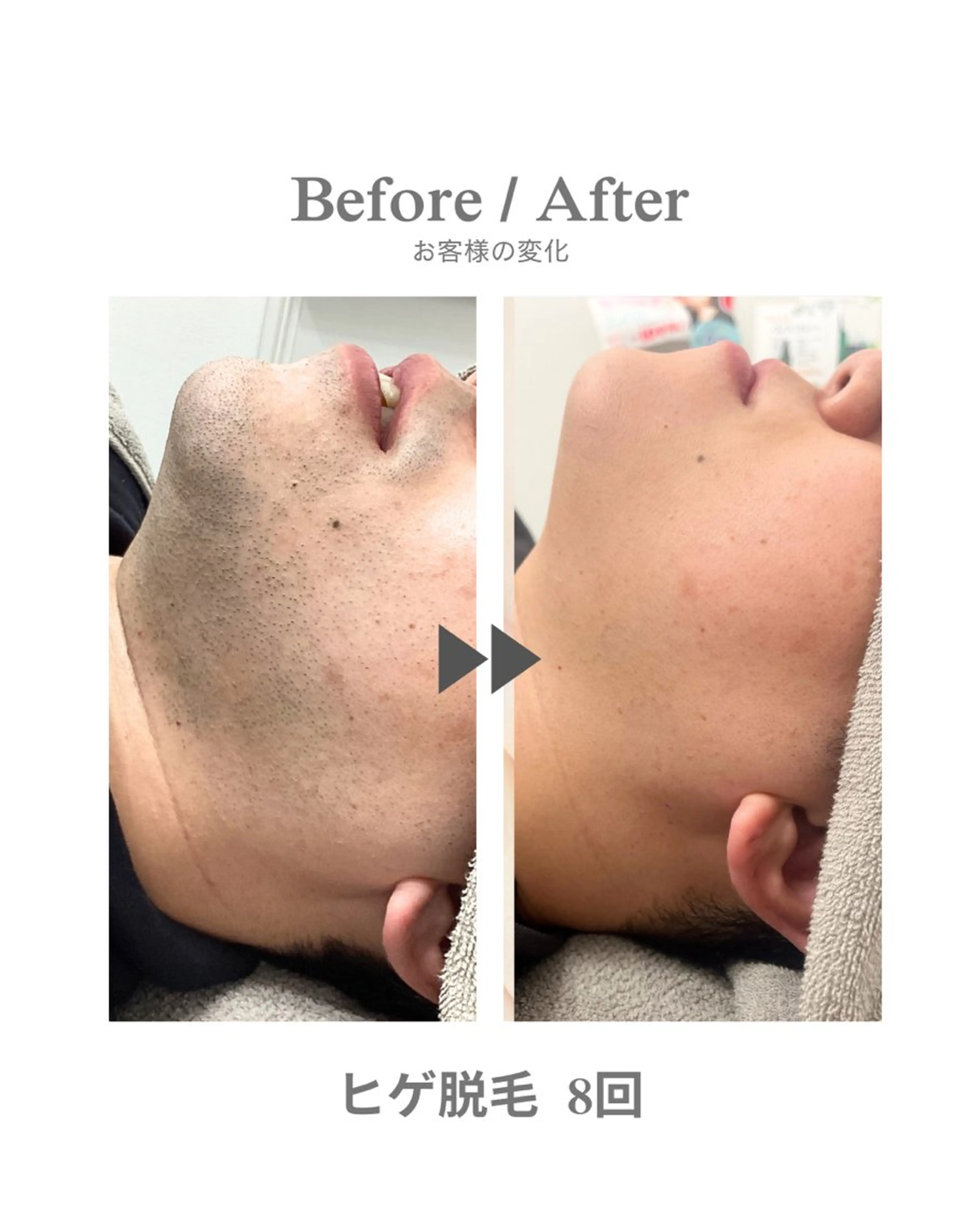 メンズ 脱毛 エステサロンNarcis〜ナルシス〜所属・脱毛＆痩身エステ Narcisのエステ・リラクイメージ