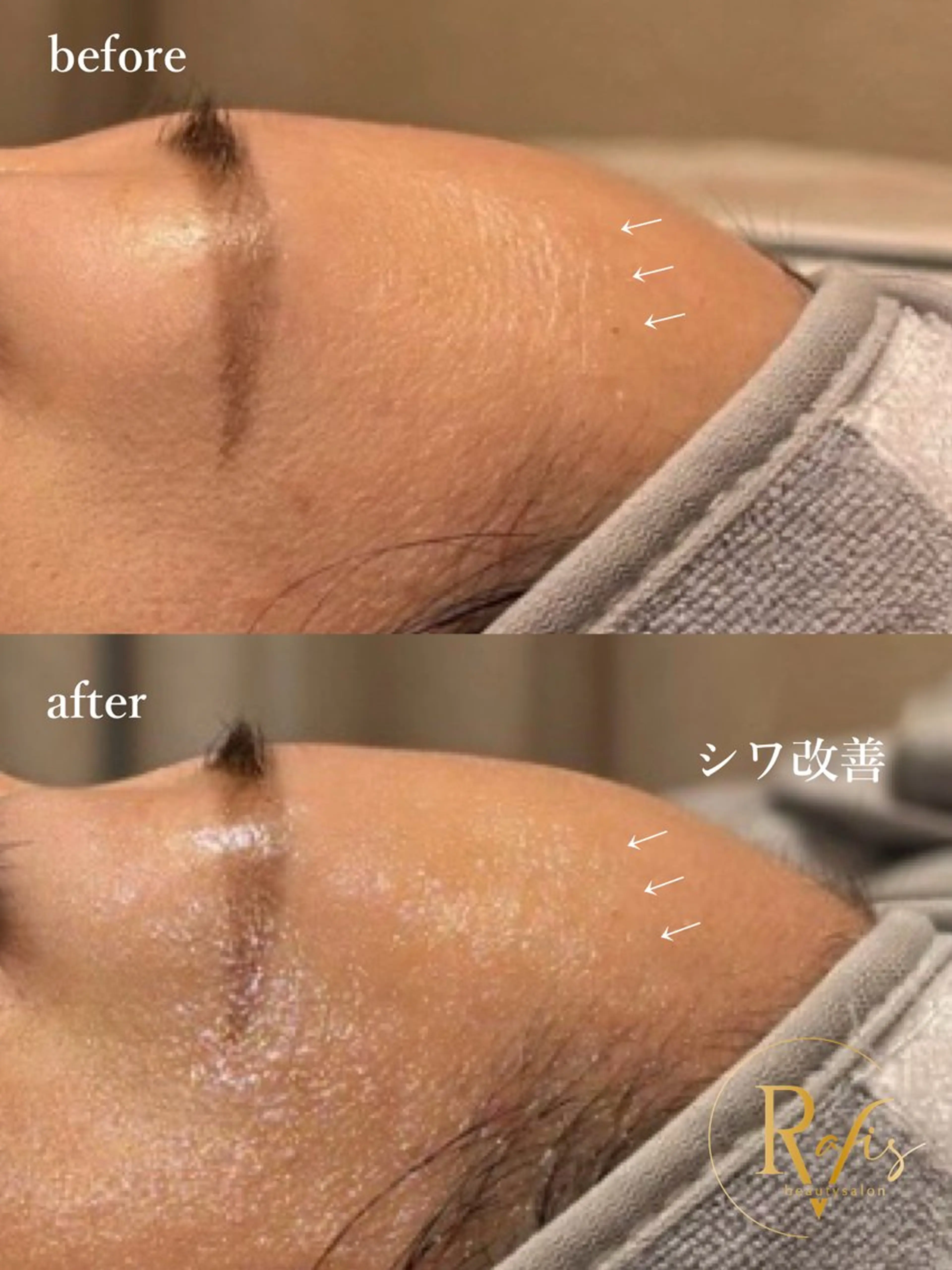 新石切ravis - ラヴィス -のその他イメージ