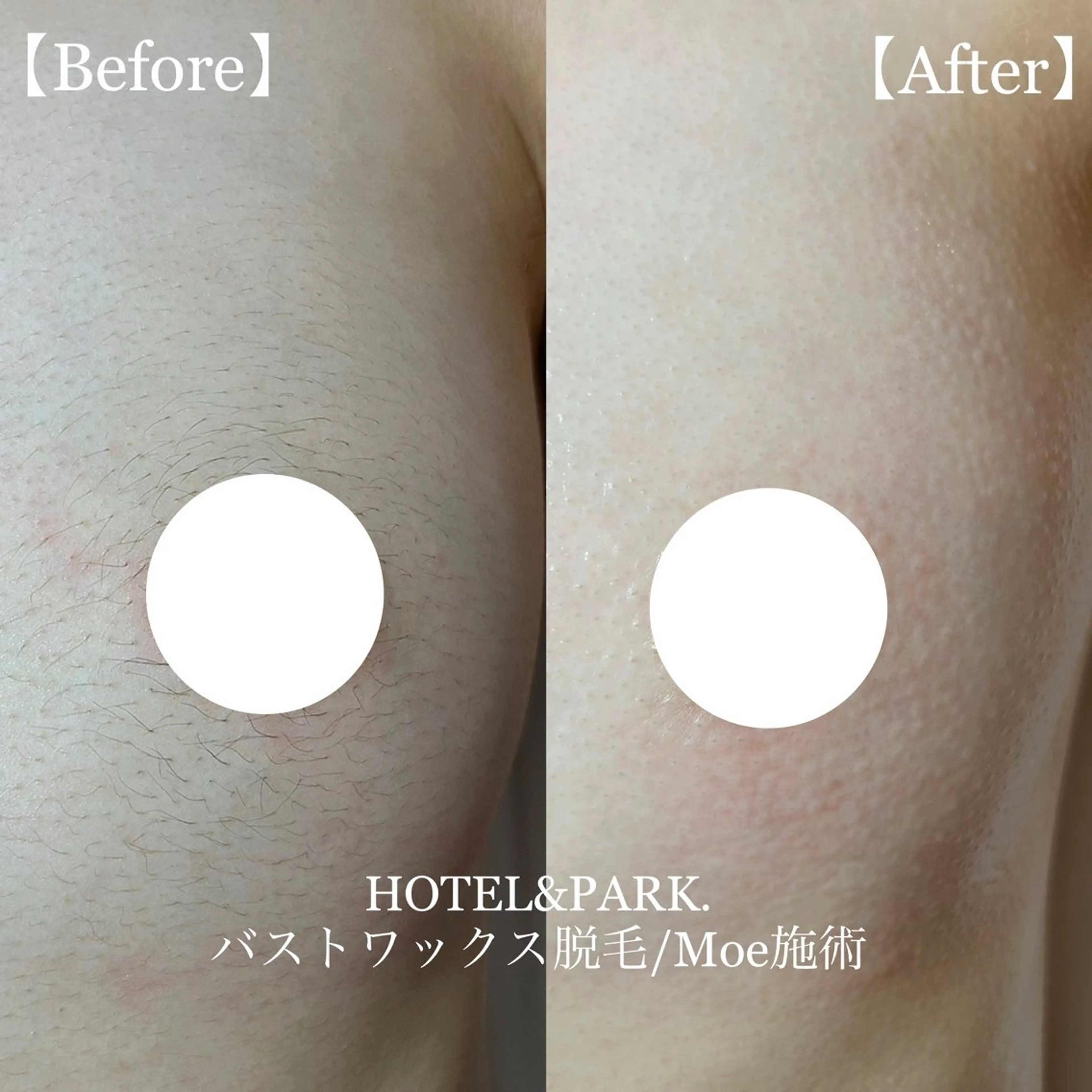 HOTEL&PARK .Moeワックス脱毛のエステ・リラクイメージ