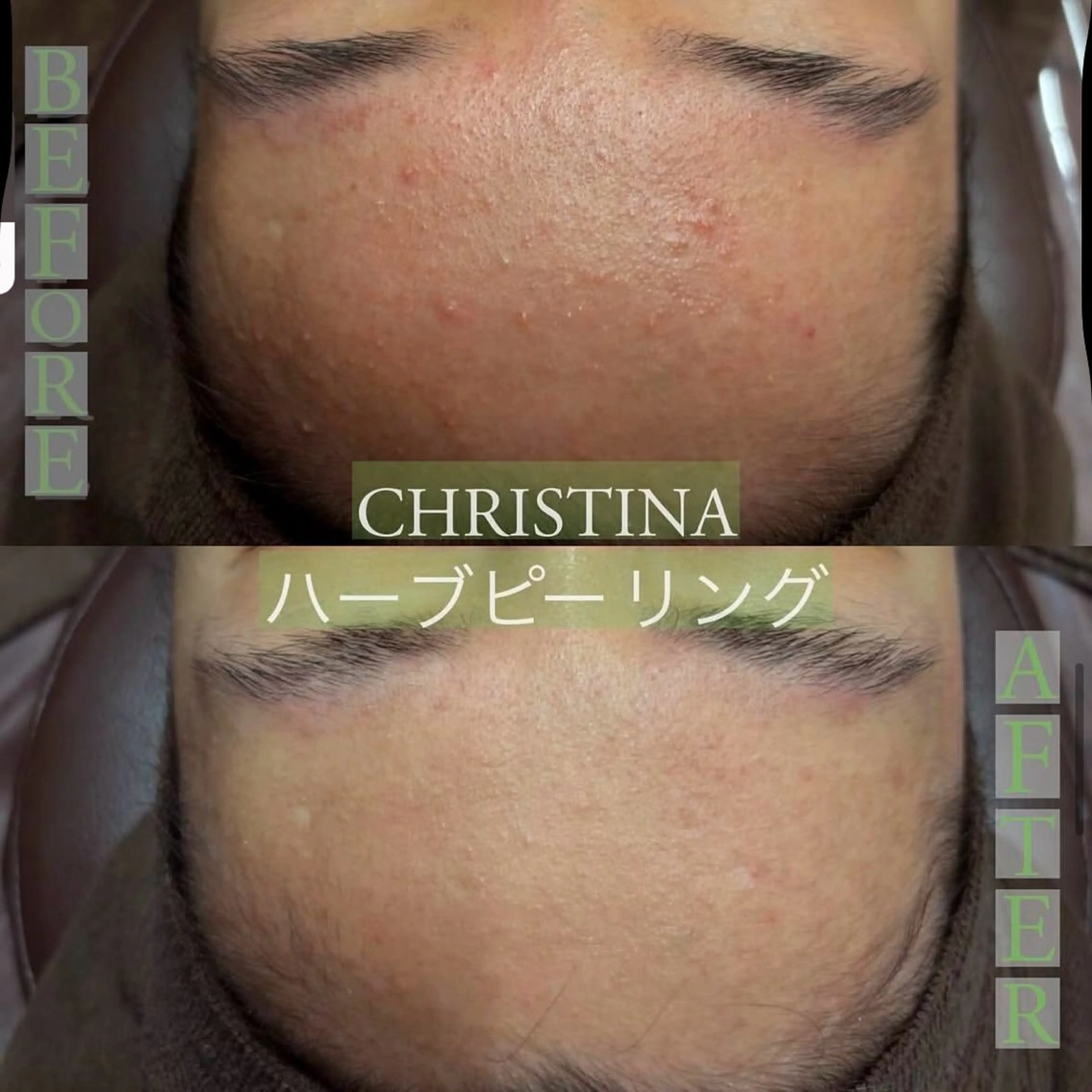 エステ Lilyboo 池袋のエステ・リラクイメージ