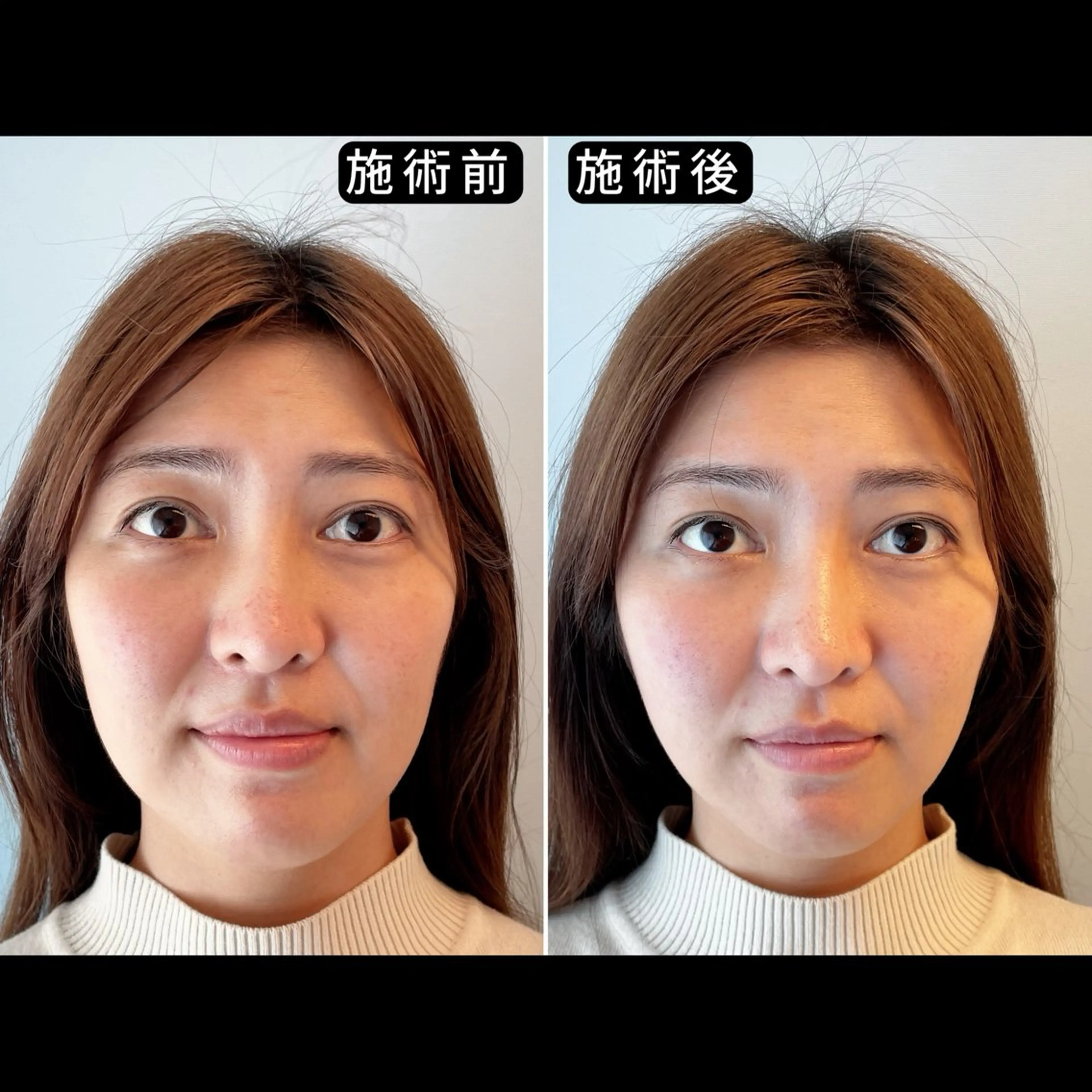 エステ リラク 渋谷 小顔美容鍼 専門サロン YZのエステ・リラクイメージ