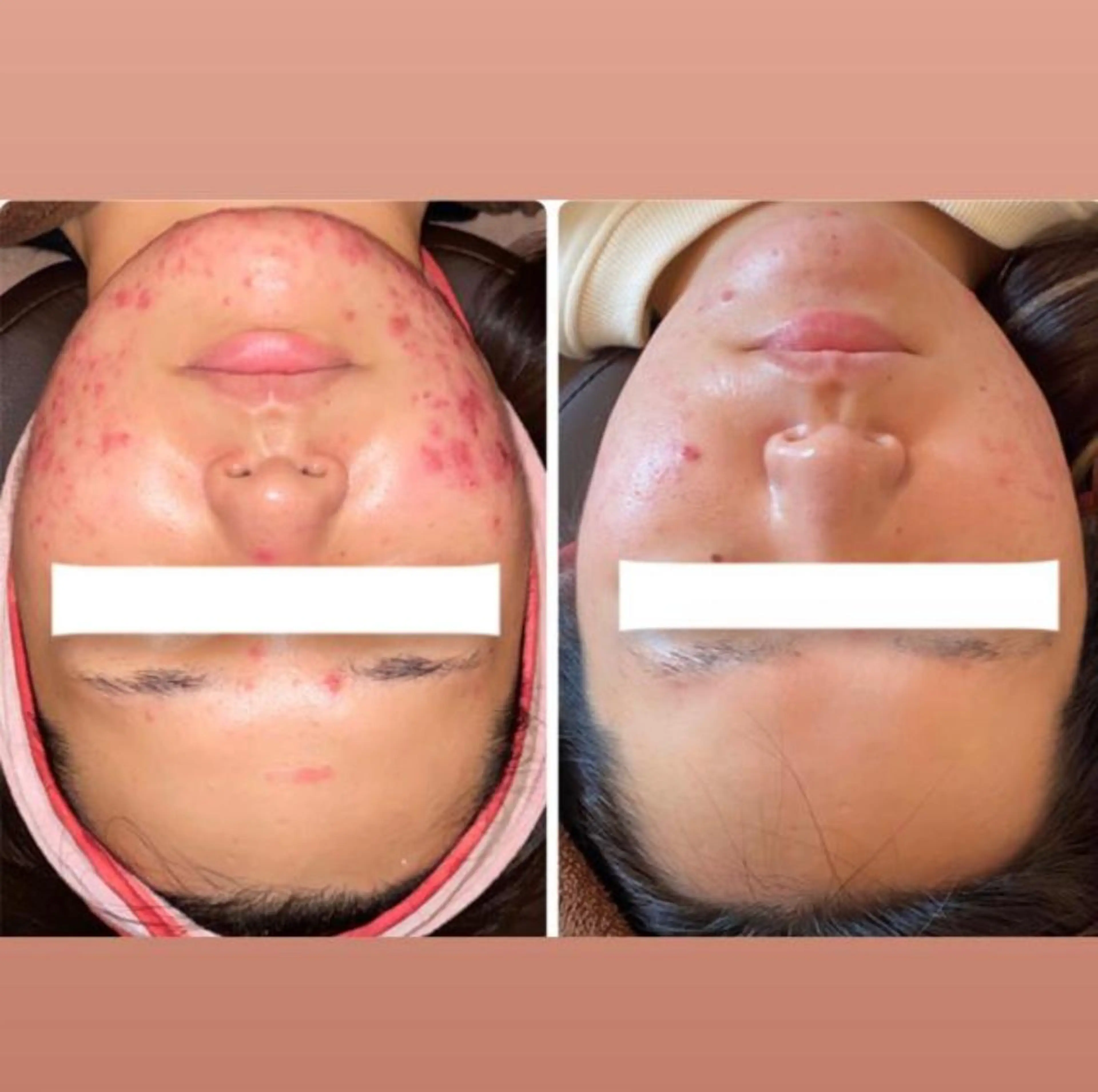 FLEUR 2号店のエステ・リラクイメージ