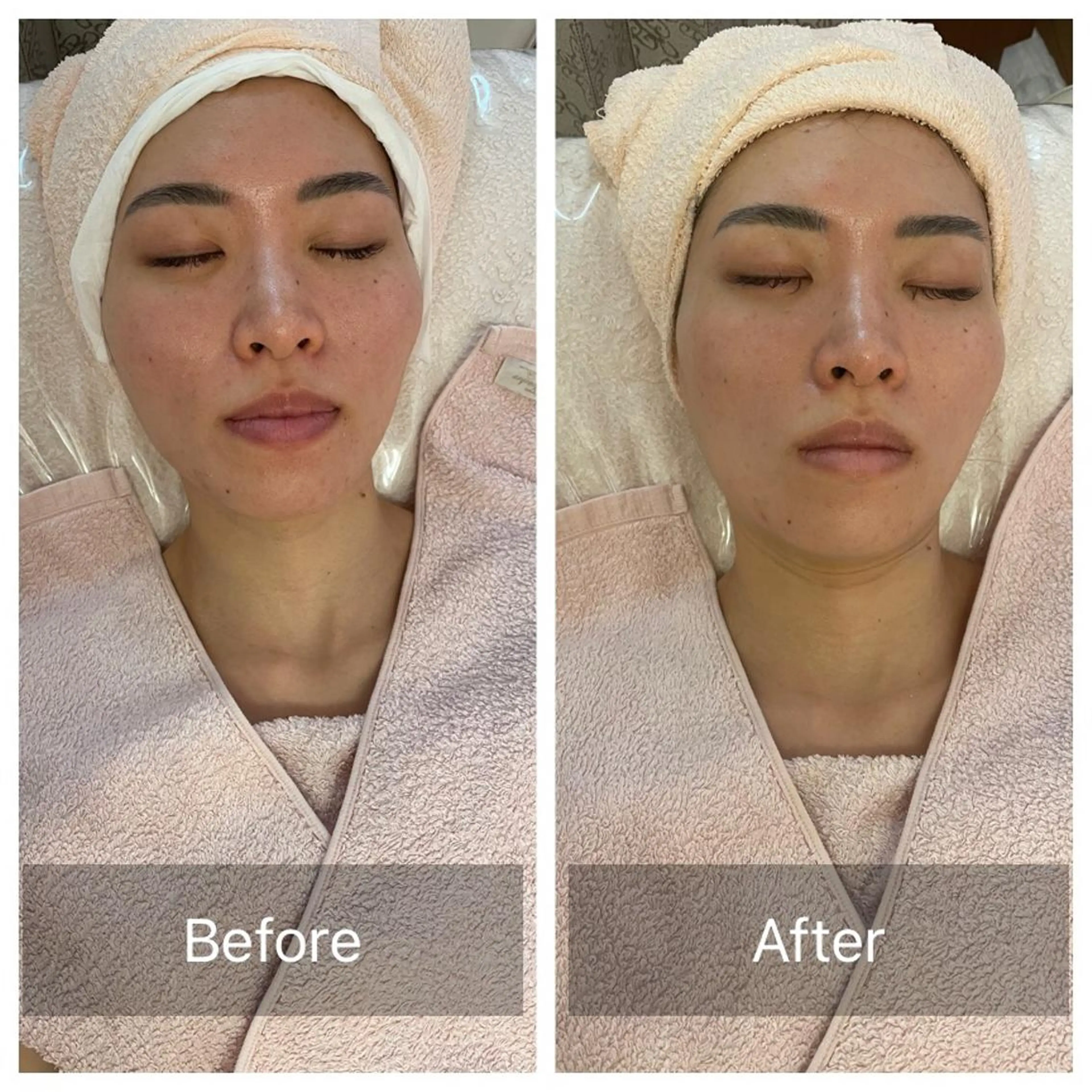 Lis Roseフェイシャルサロン所属・Lis Rose🥀 フェイシャルサロンのエステ・リラクイメージ