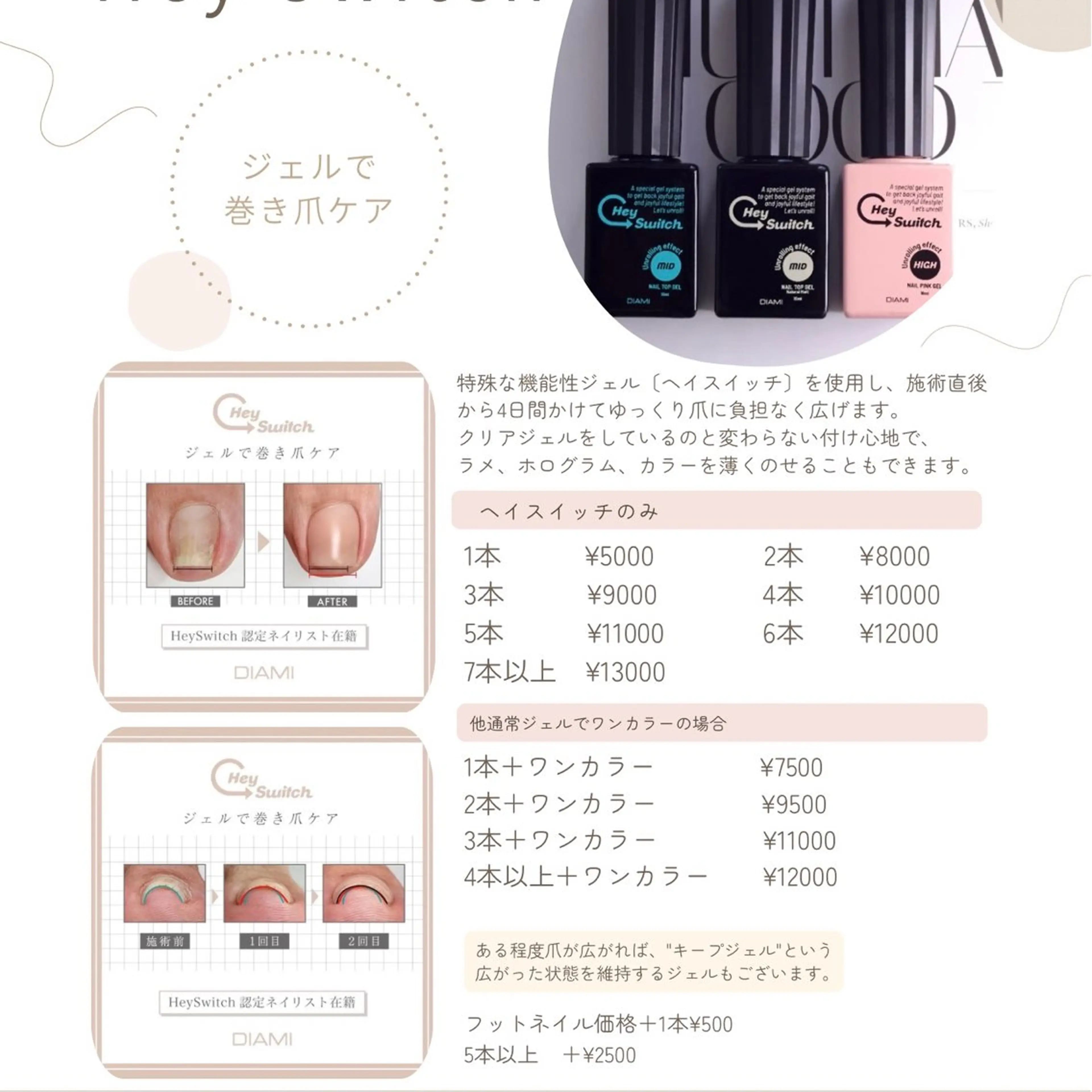 巻き爪ケア 〔ヘイスイッチ〕の写真