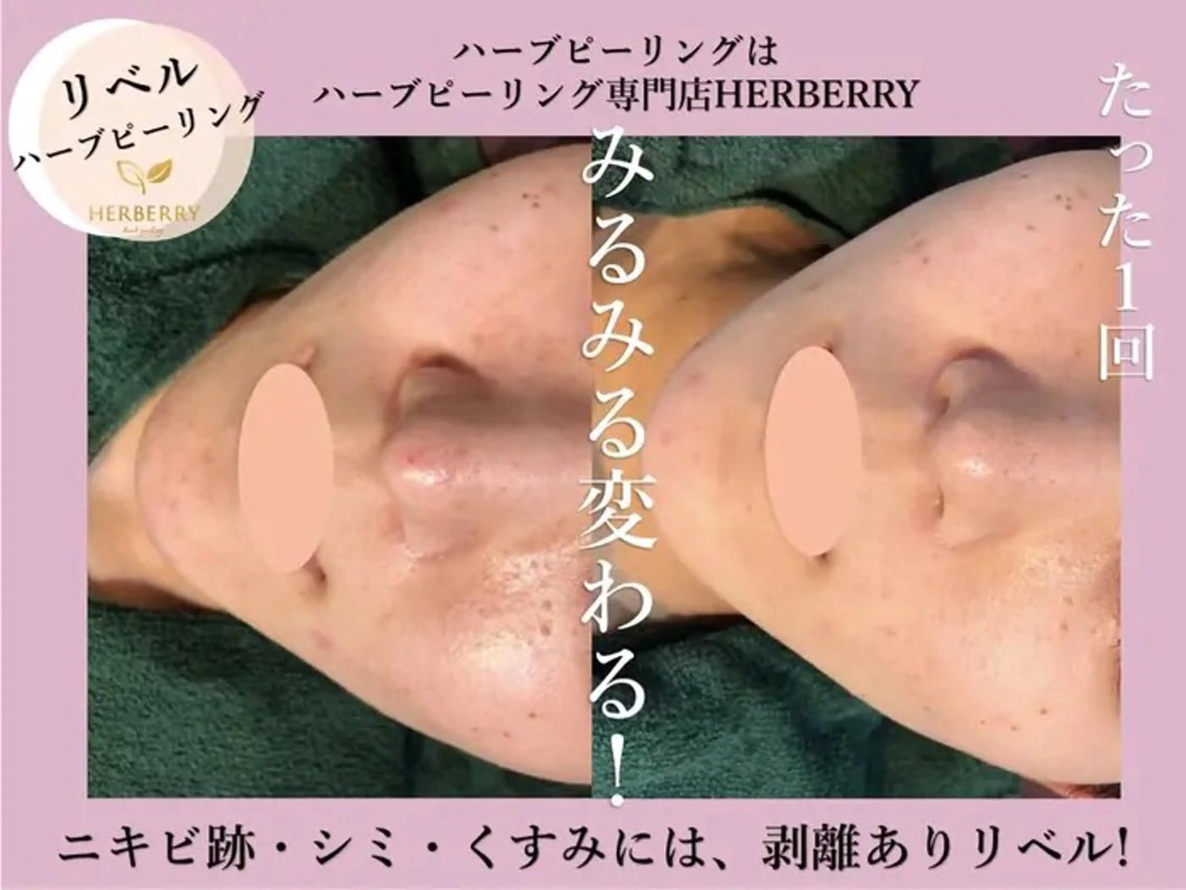 ハーブピーリング専門店HERBERRY難波心斎橋店所属・ハーブピーリング専門 HERBERRY冨永のエステ・リラクイメージ