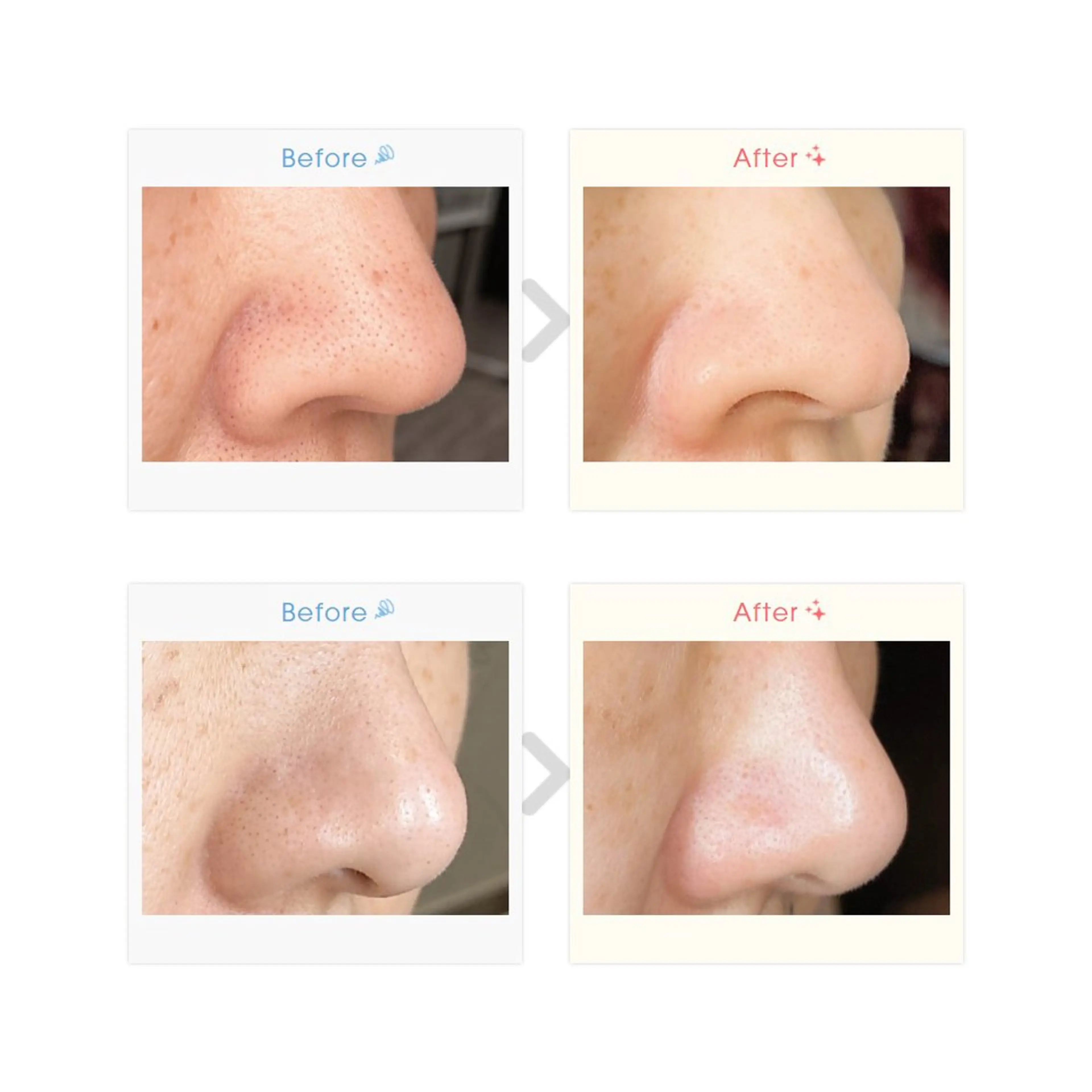 NAYU/レディース 眉毛/堺筋本町の眉毛・アイブロウイメージ