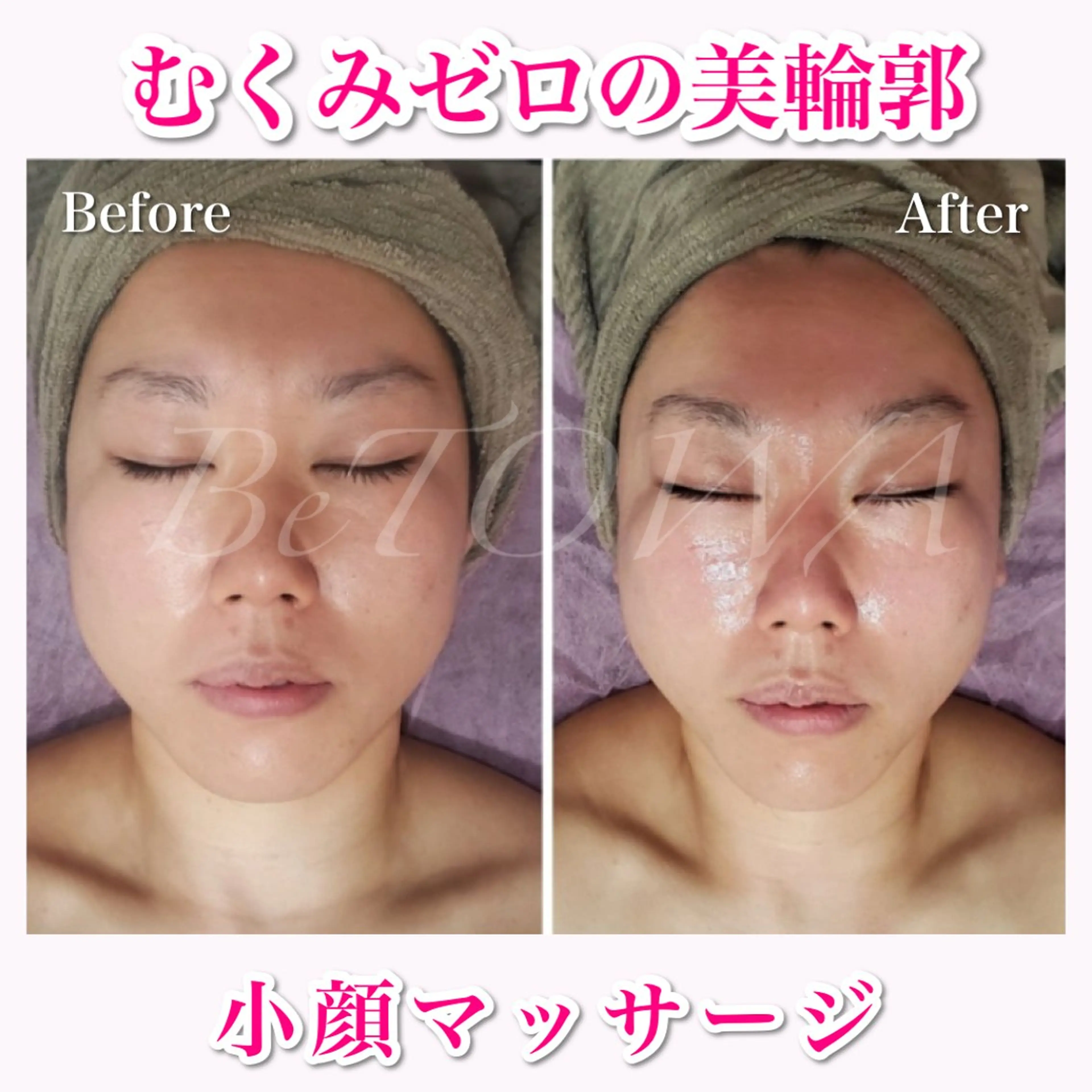 【フェイシャルマッサージ】フェイシャル+首肩+ヘッドマッサージ+パック🫧 SNSモニターモデル✨メンズOK🧢の写真