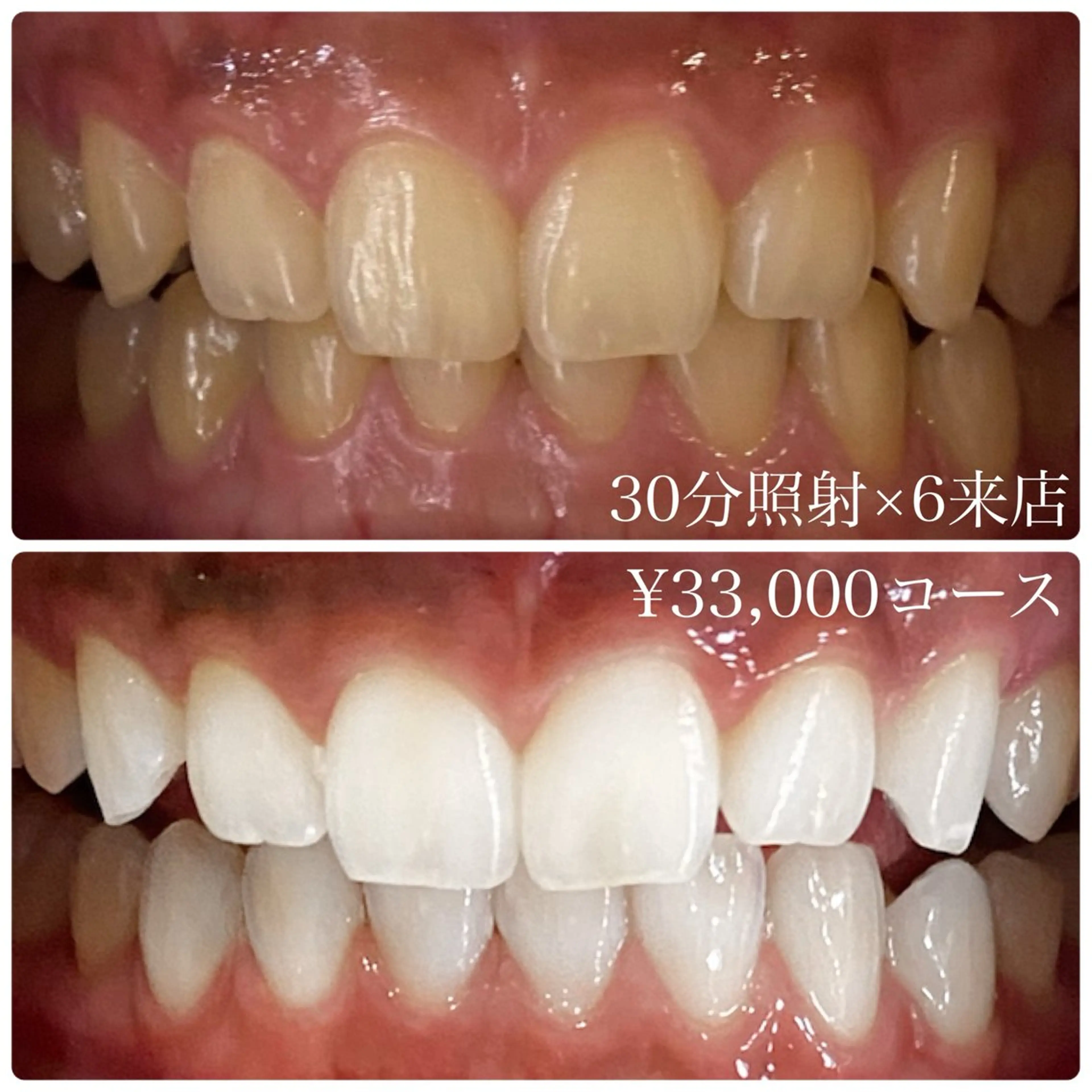 メンズ その他 ホワイトニングルーム　川崎店所属・ホワイトニング ルーム　川崎店のその他イメージ