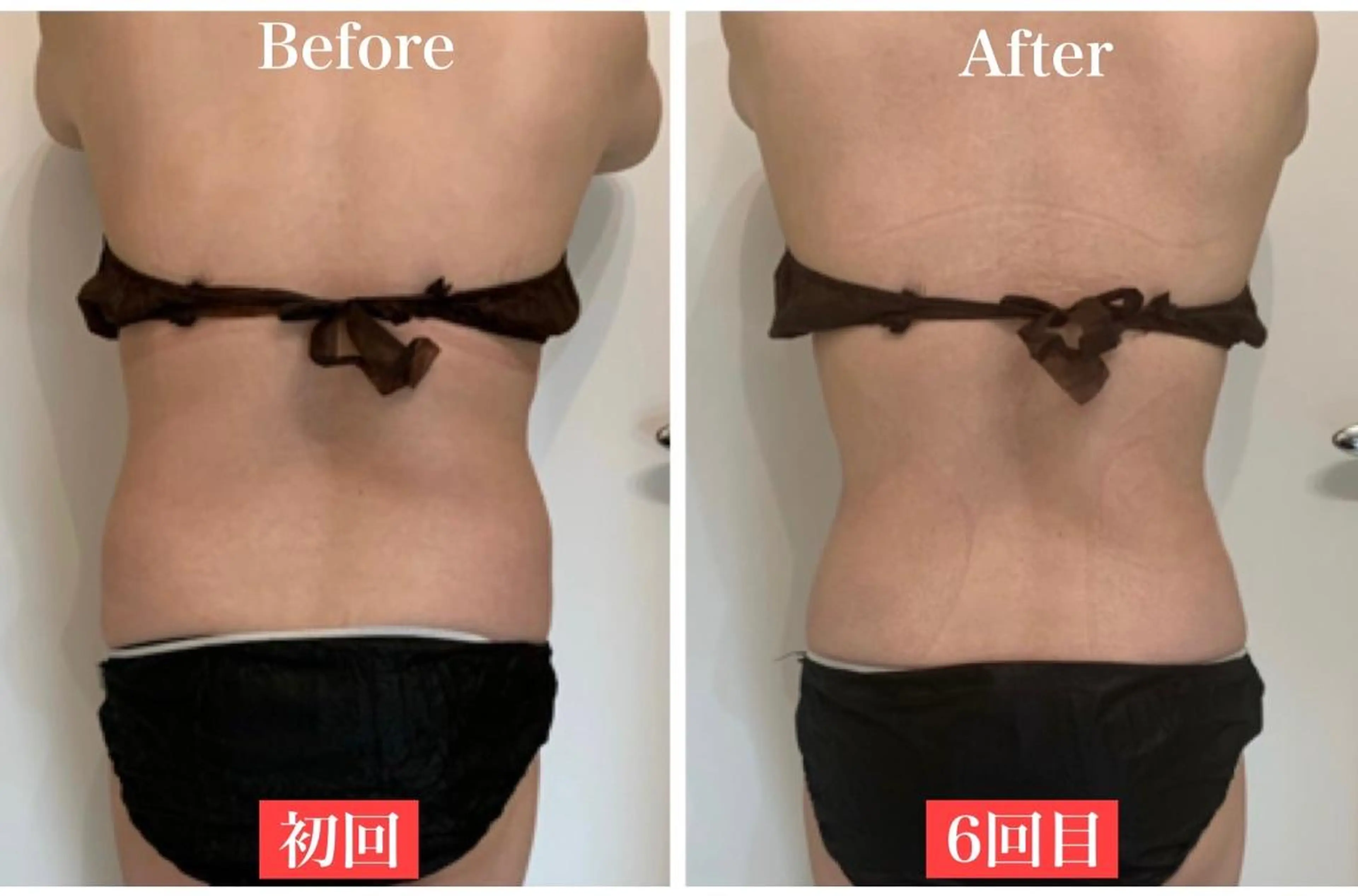 ✨美肌水光✨ アトリエリュバンのエステ・リラクイメージ