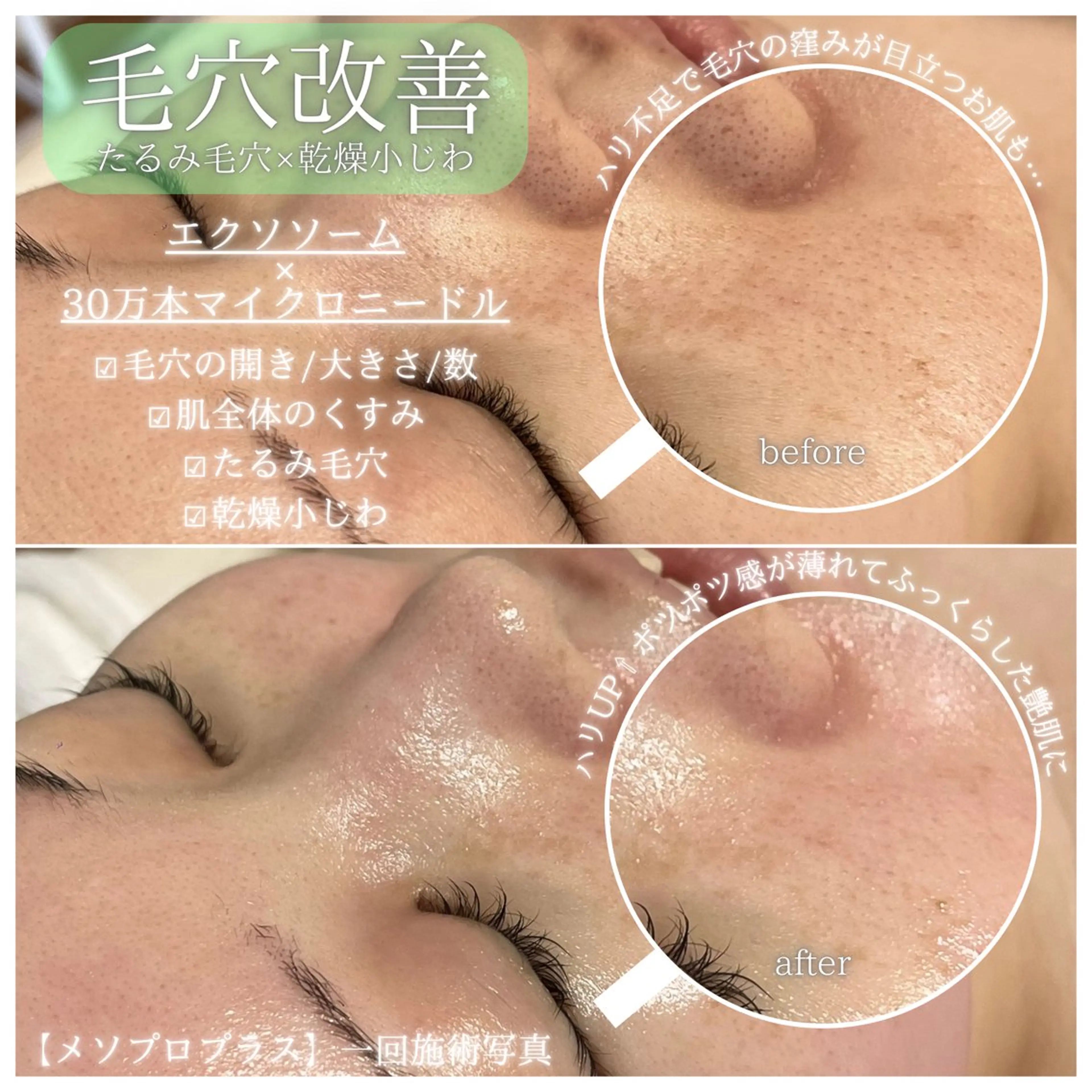 エステ リラク La Dusa 韓国肌管理/小波のエステ・リラクイメージ