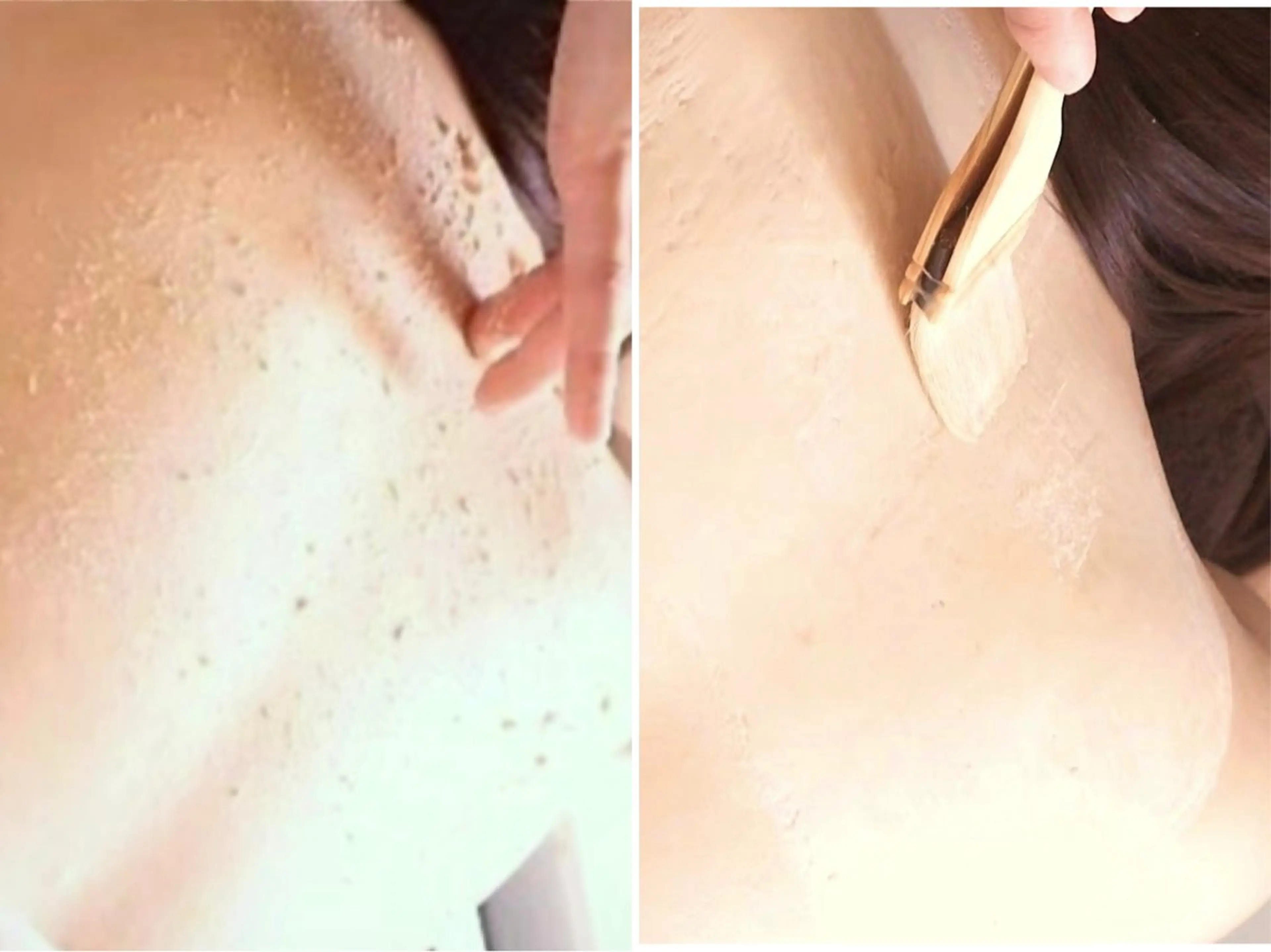 【背中の肌悩み💪※半面】ざらつきやニキビケア・跡🌈ブライダルやお悩みの方へ (施術時間90分)の写真