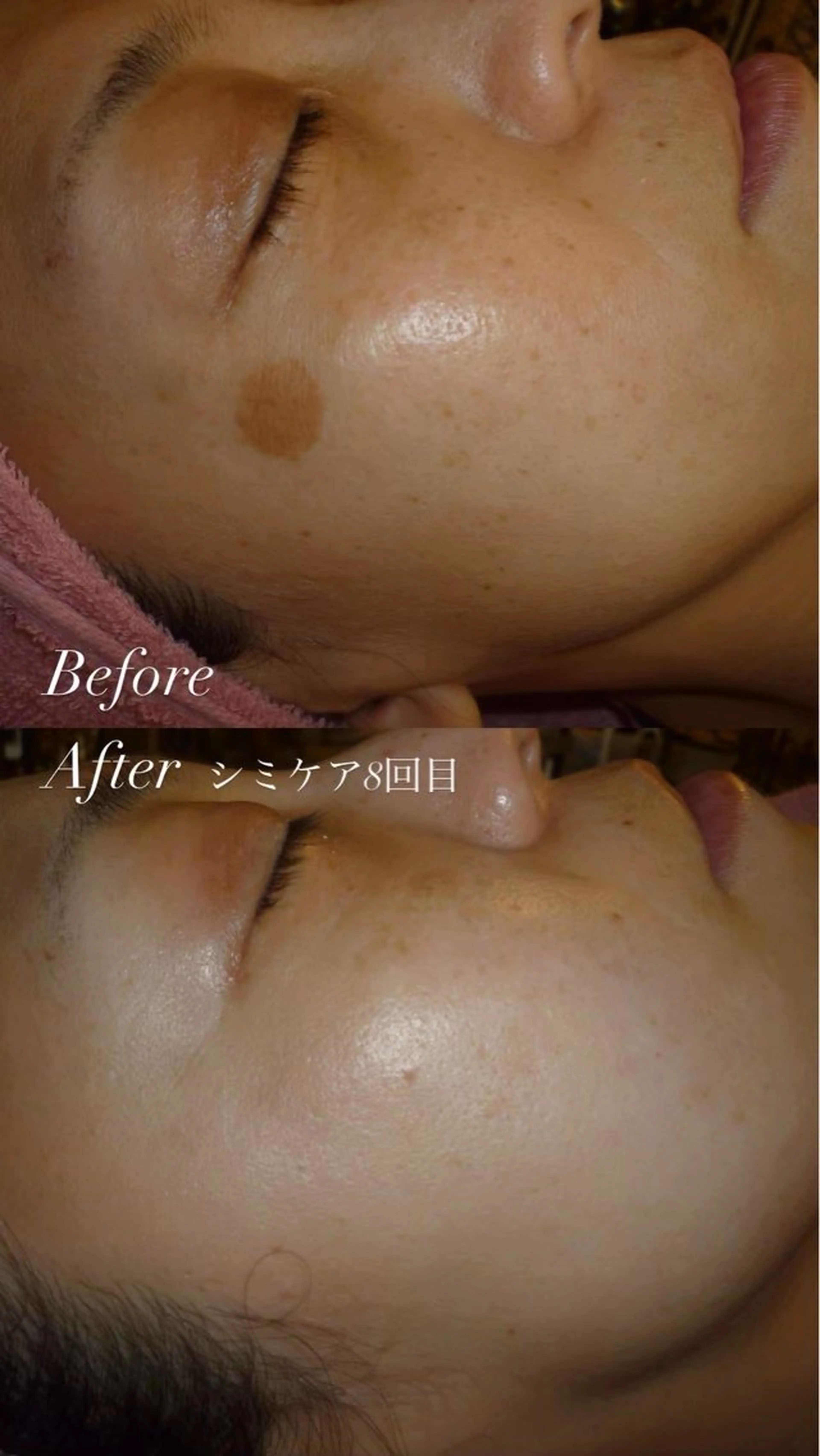 エステ # fu♡のエステ・リラクイメージ