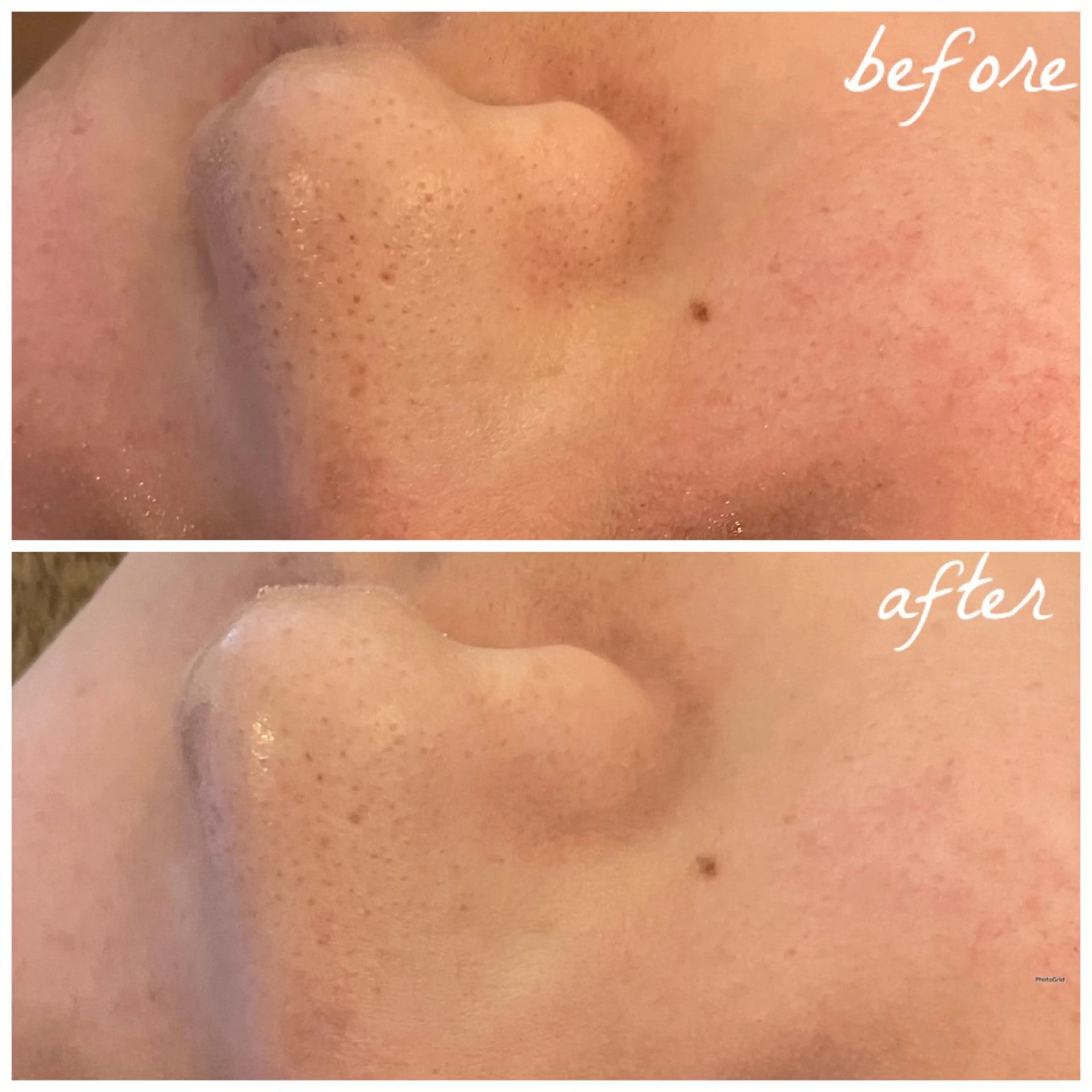 メンズ メナード岐阜茜部 杉浦のエステ・リラクイメージ