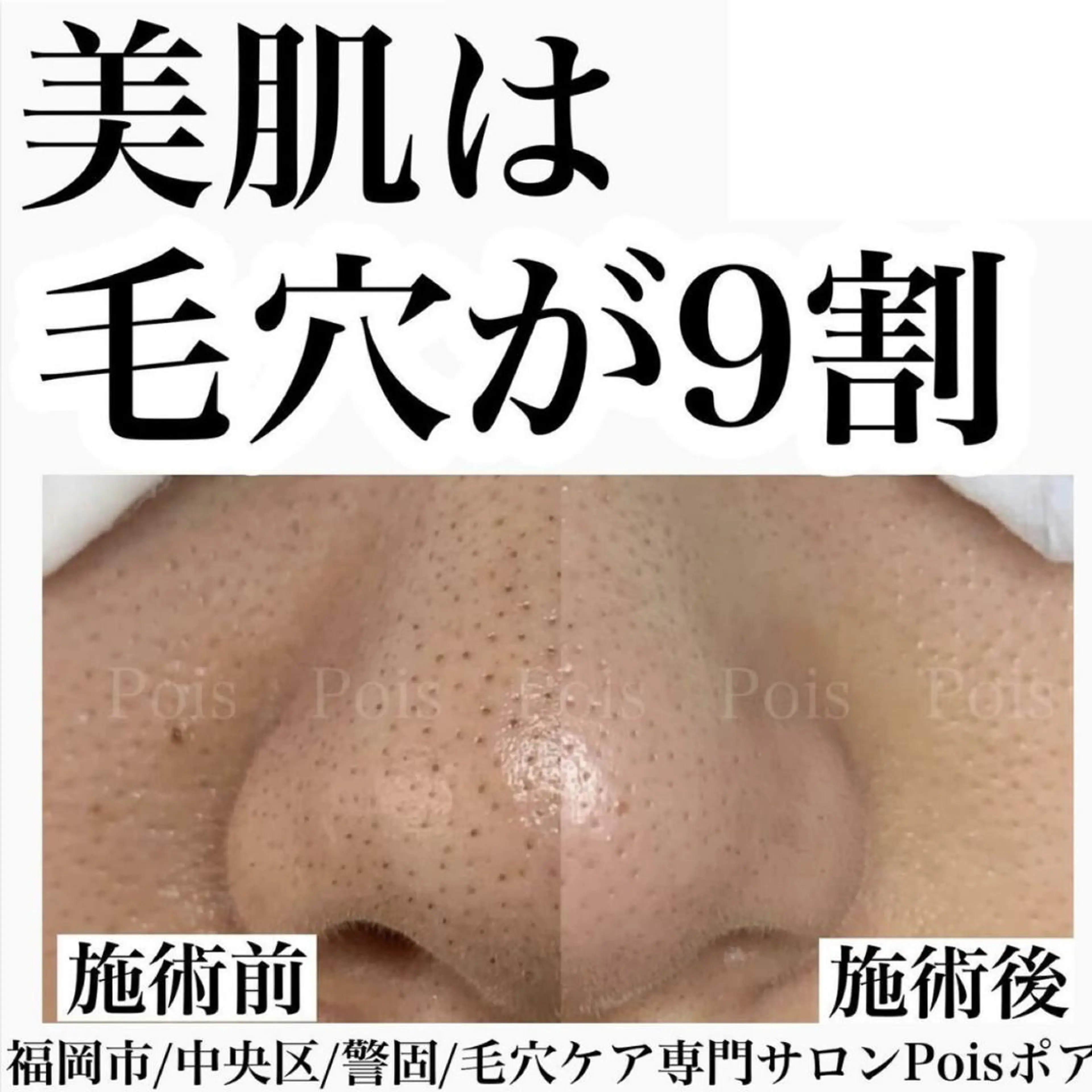 まつげどころPois ハセガワのマツエク・マツパデザイン