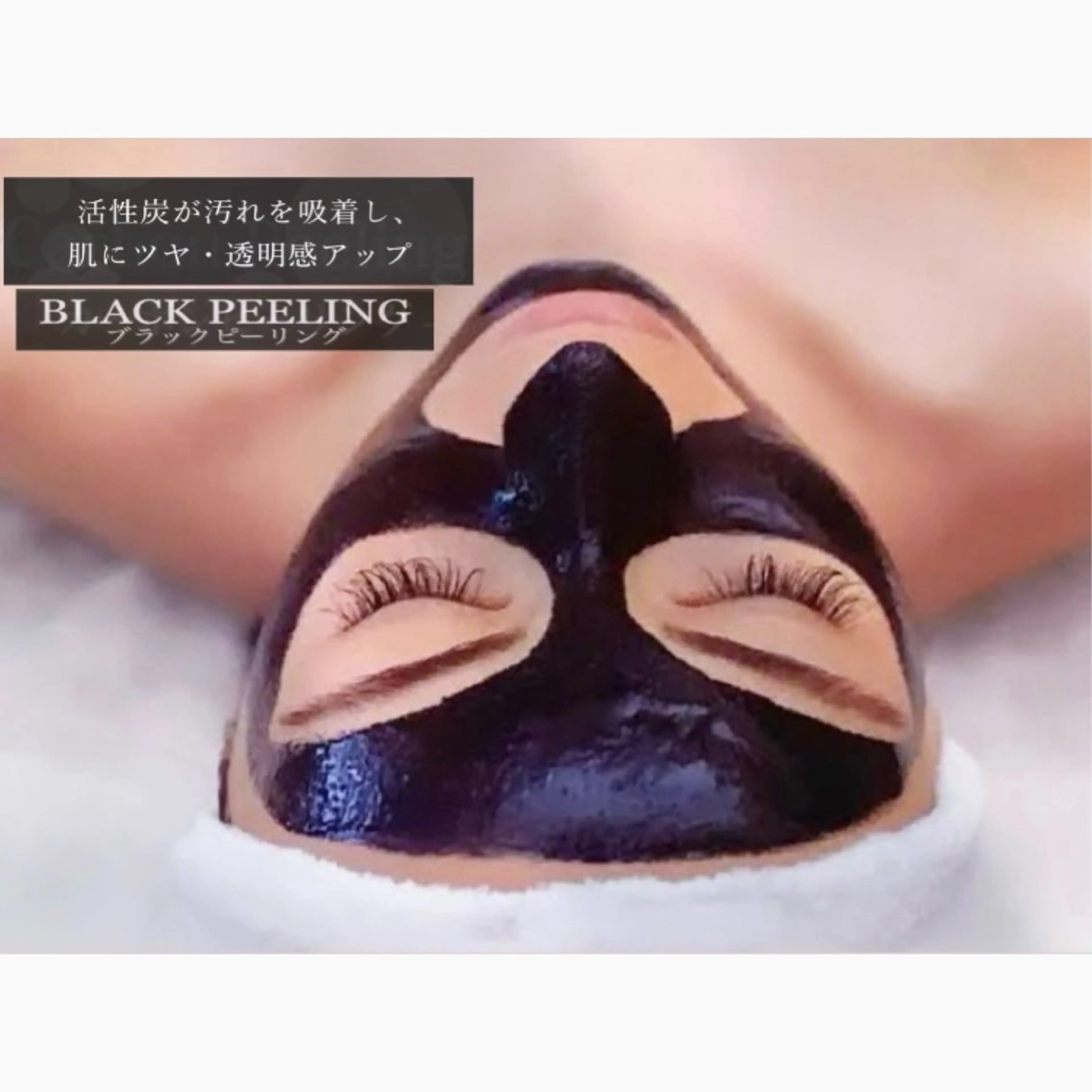 ≪脂性肌ニキビケア≫ニキビ皮脂ケア/肌質再生LED光照射+皮脂吸着ブラックピーリングの写真