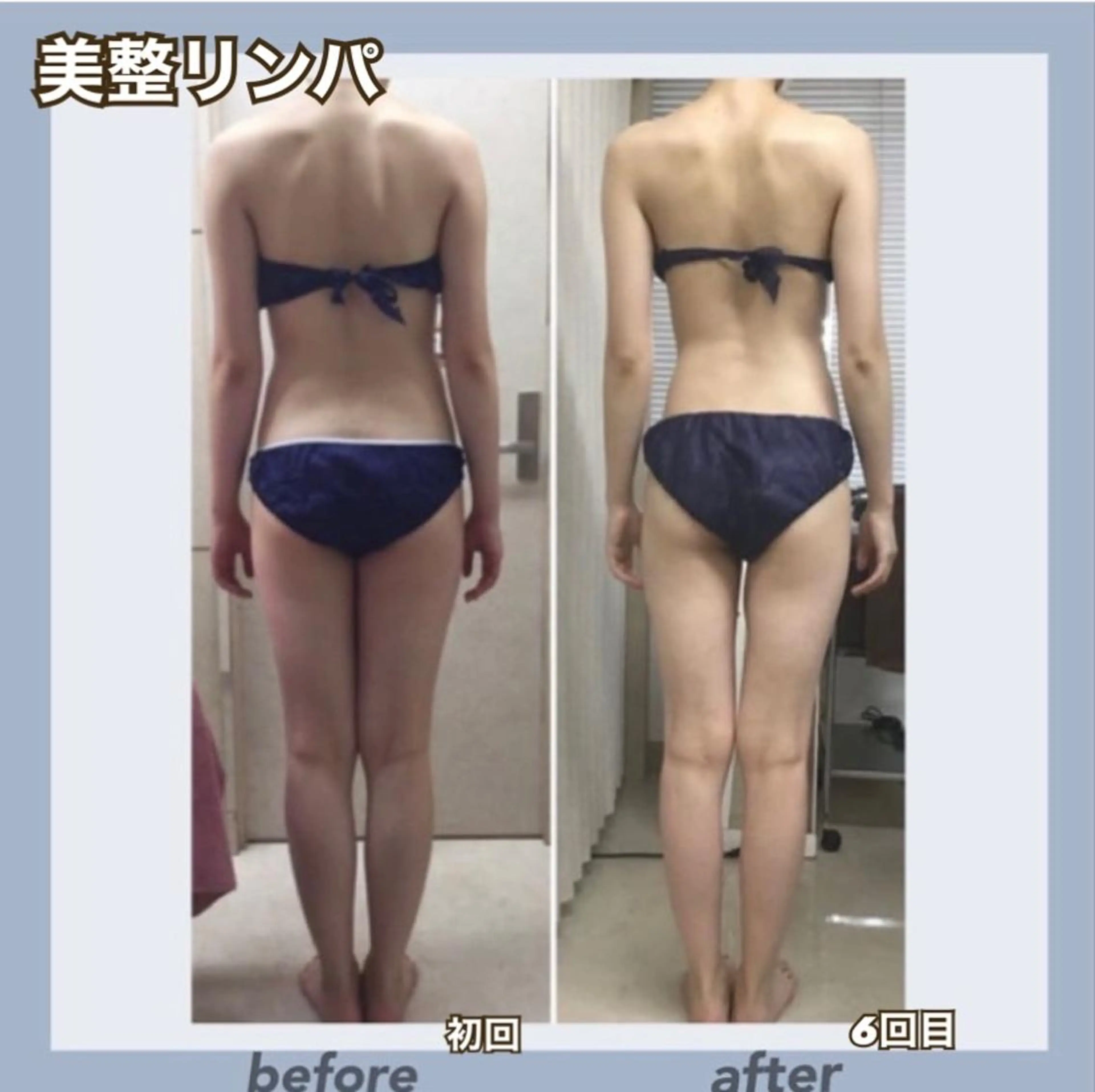 RAYVIS 郡山店のエステ・リラクイメージ