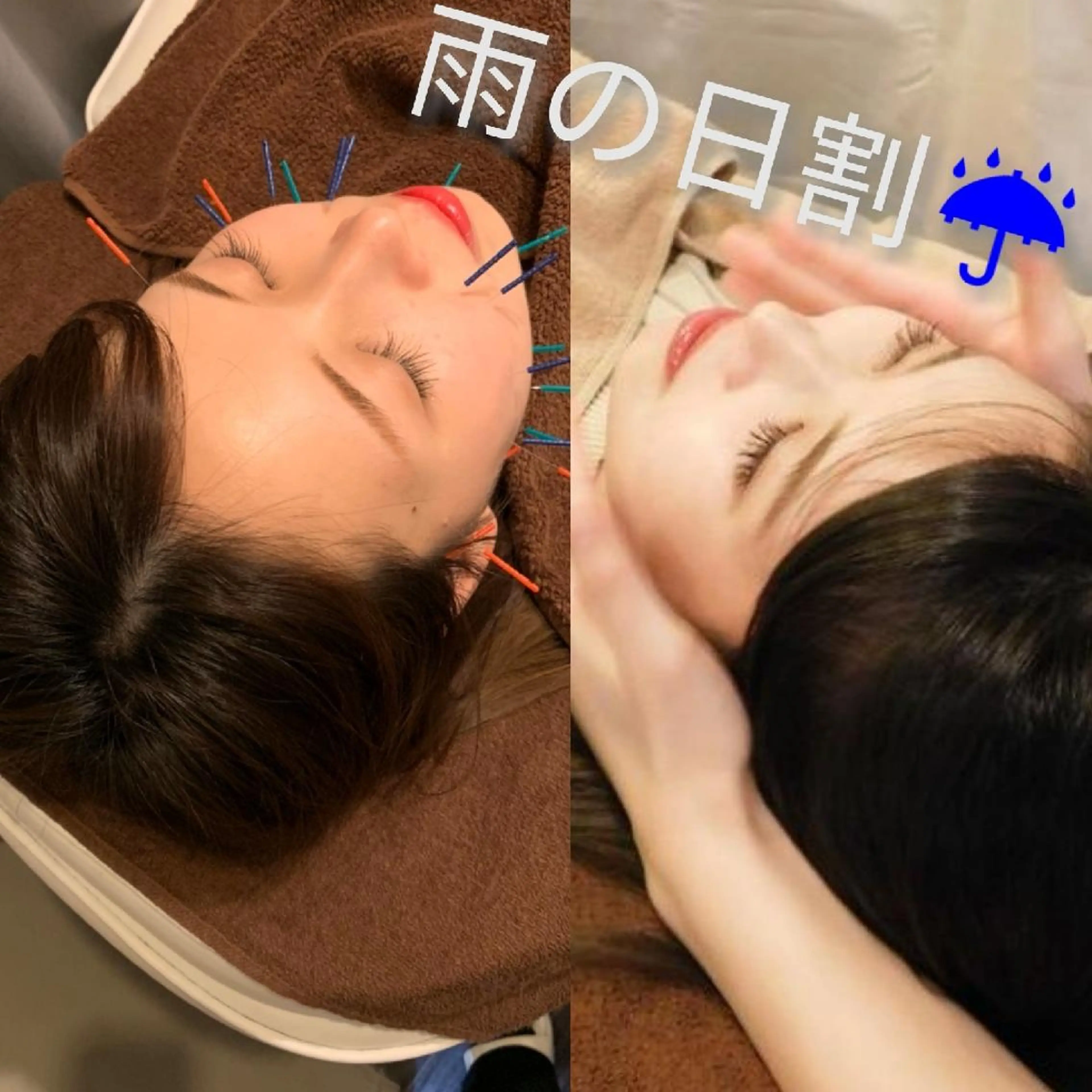 たるみ専門美容鍼 × 猫背整体 のぐち所属・小顔と姿勢改善のプロ ｜整体と美容鍼のぐちのエステ・リラクイメージ