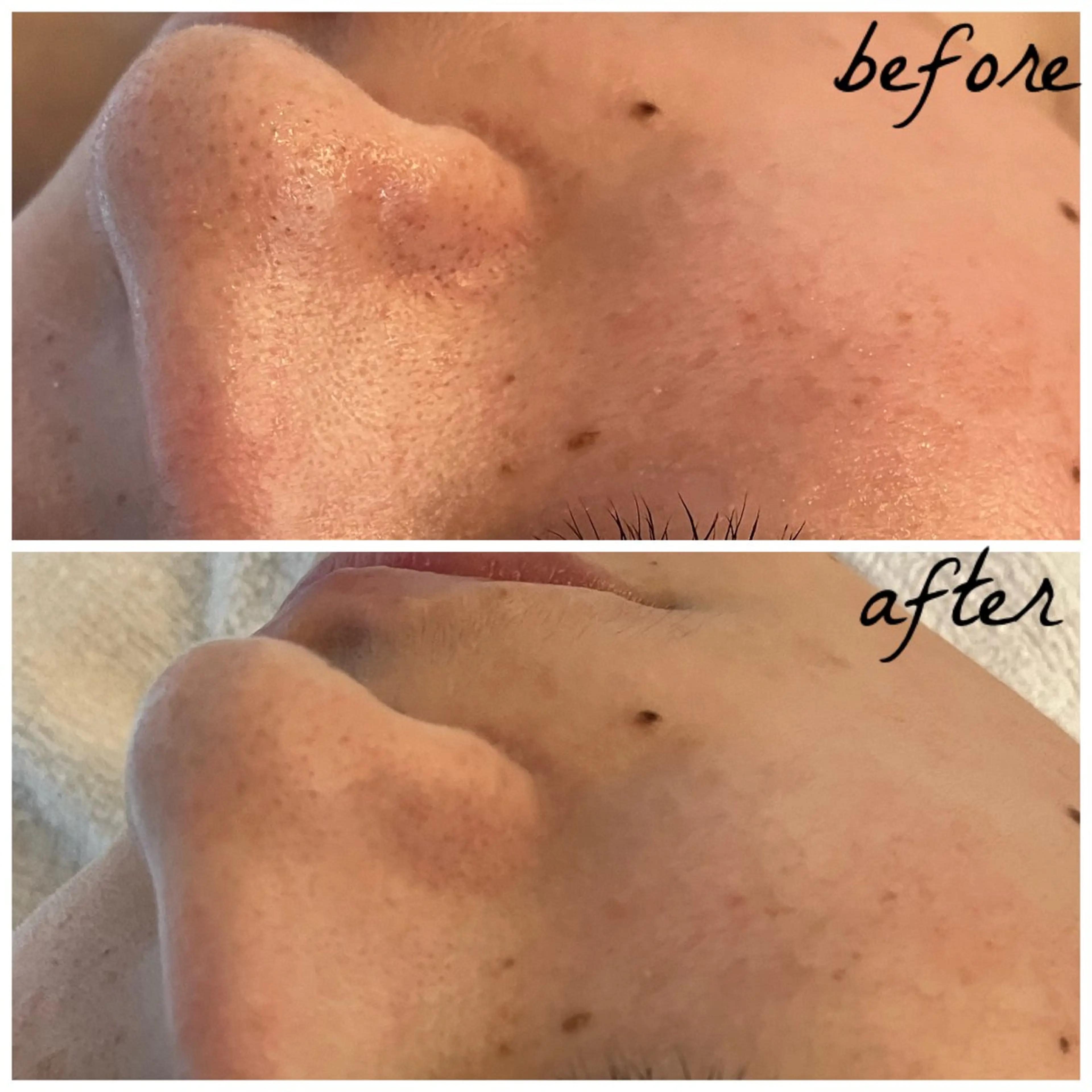 メンズ メナード岐阜茜部 杉浦のエステ・リラクイメージ