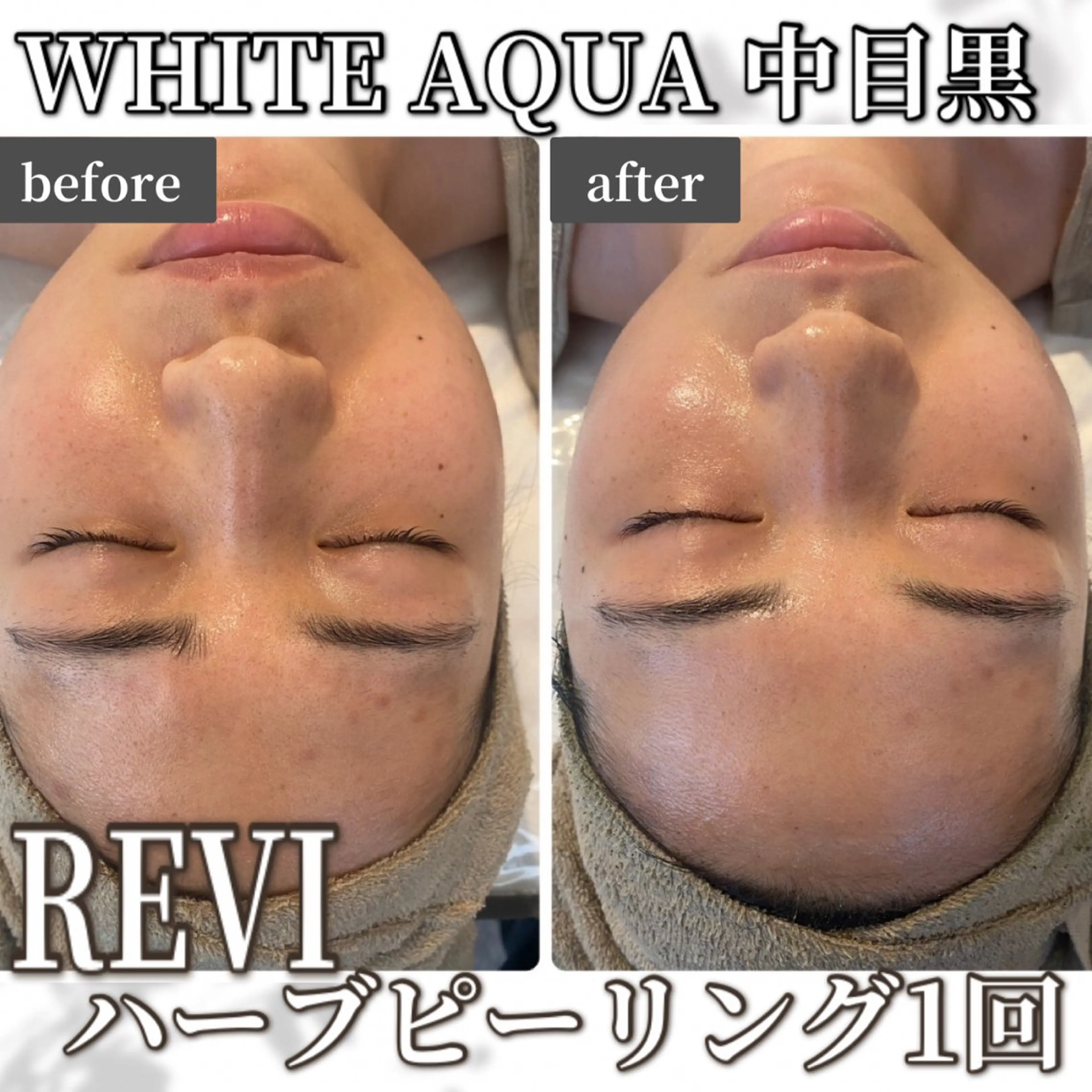 中目黒ハーブピーリン グ🌿ララピールのエステ・リラクイメージ