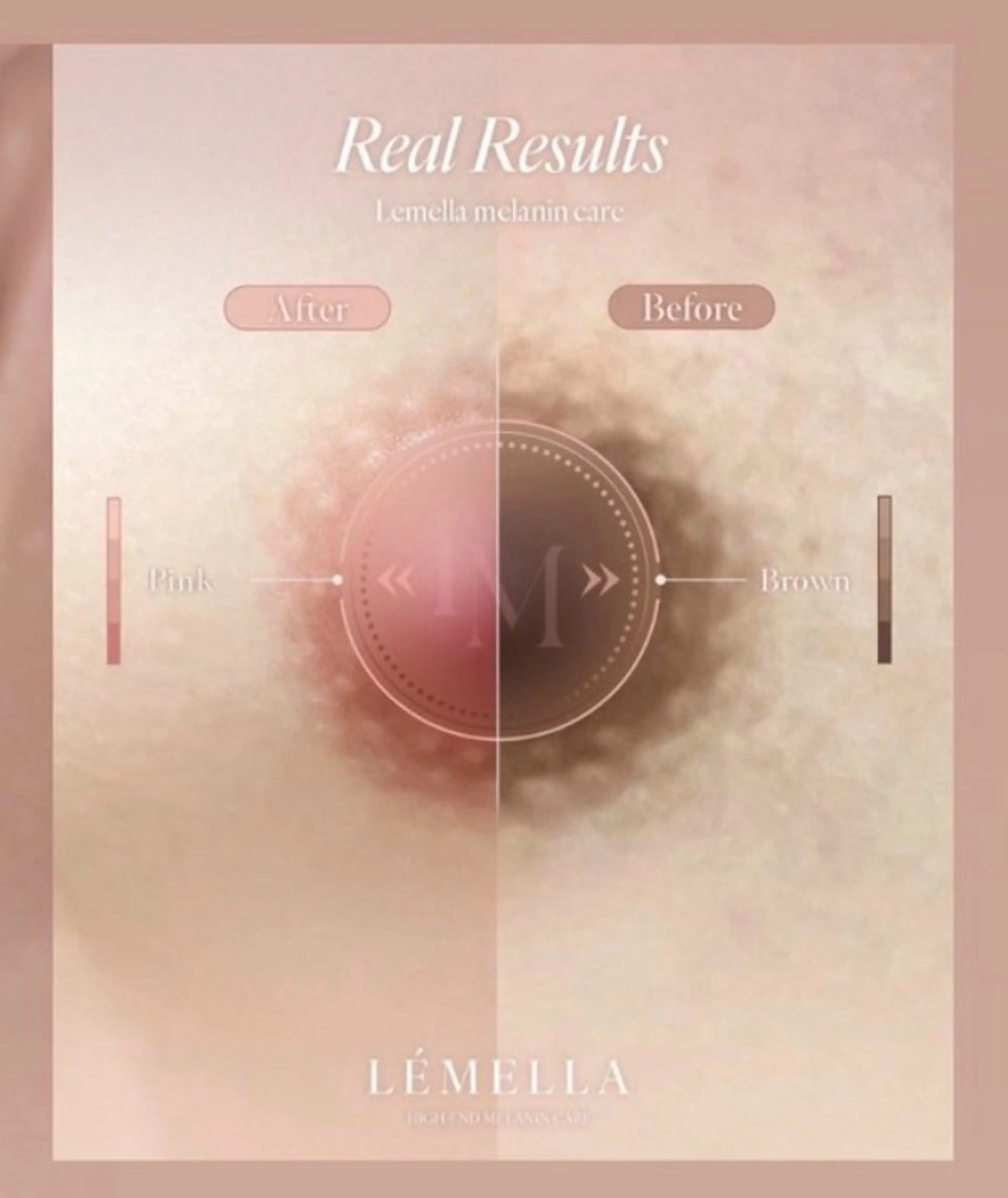 その他 MiMi所属・ヘアセット/ネイル/ メラニンケア/えりかのネイルデザイン