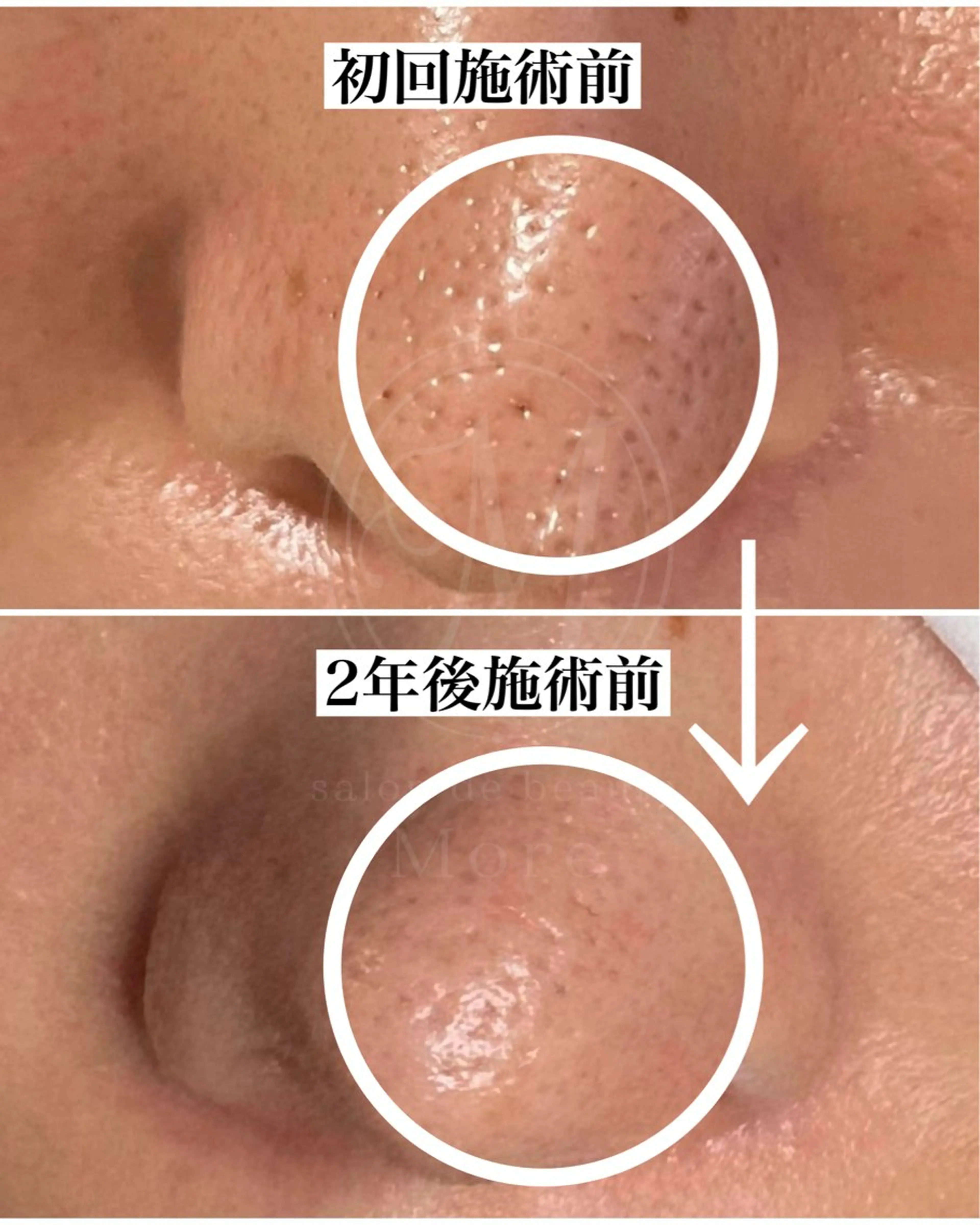 エステ salon de beauté More所属・More 大阪福島区 毛穴・肌質改善のエステ・リラクイメージ