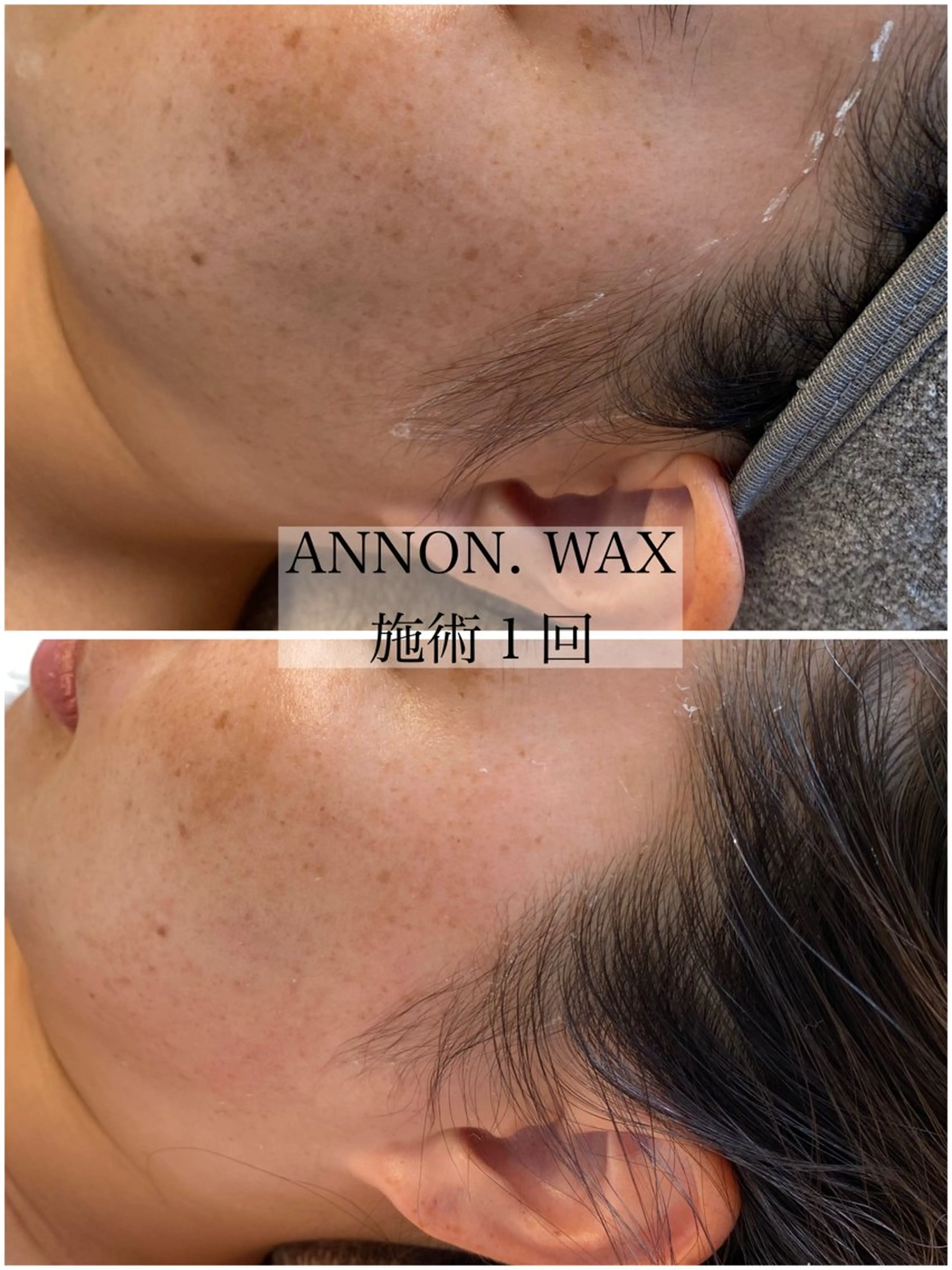 エステ 肌質改善ワックス専門 yukiのエステ・リラクイメージ