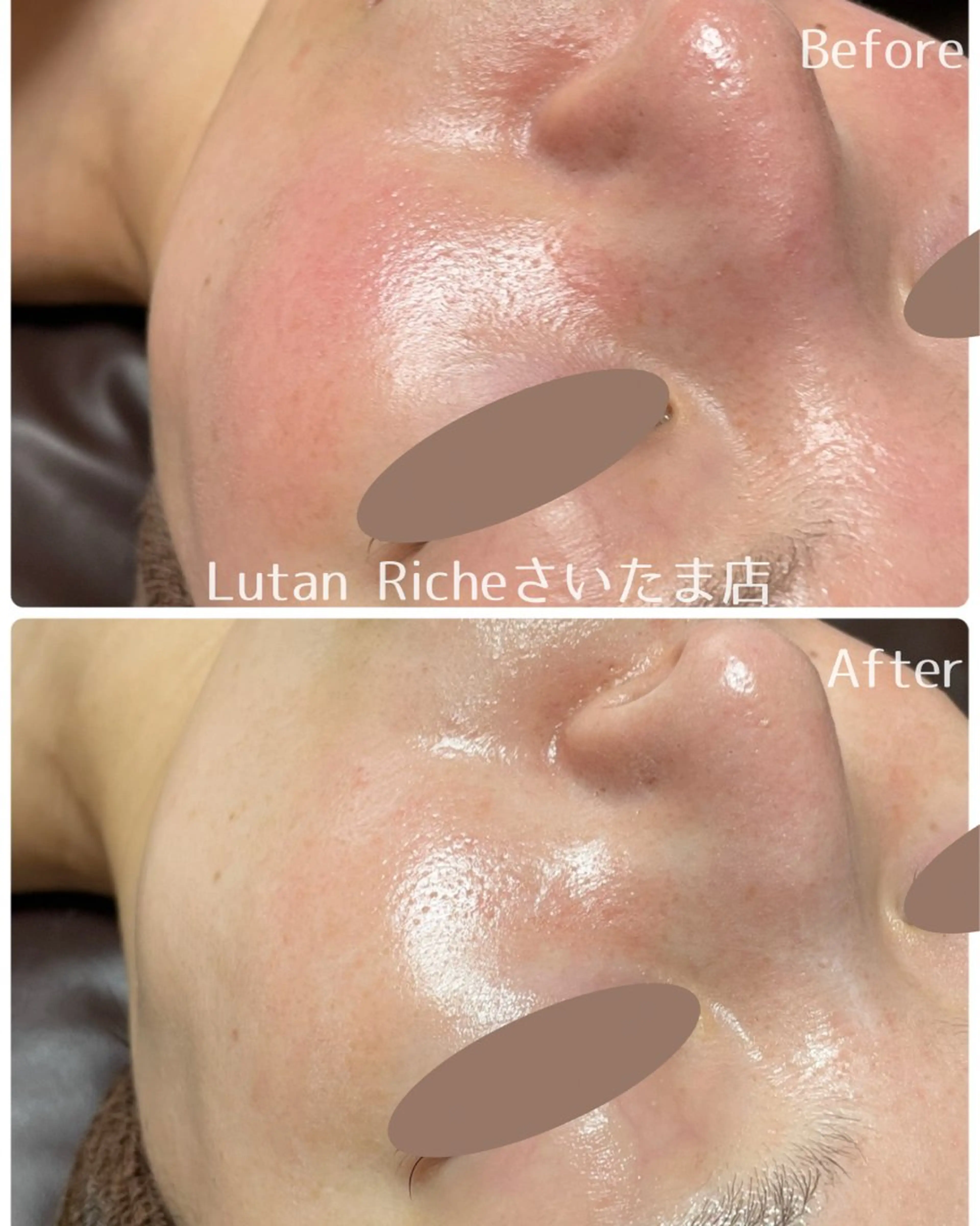 Lutan Richeさいたま店所属・ルタンリッシュ さいたま店のエステ・リラクイメージ