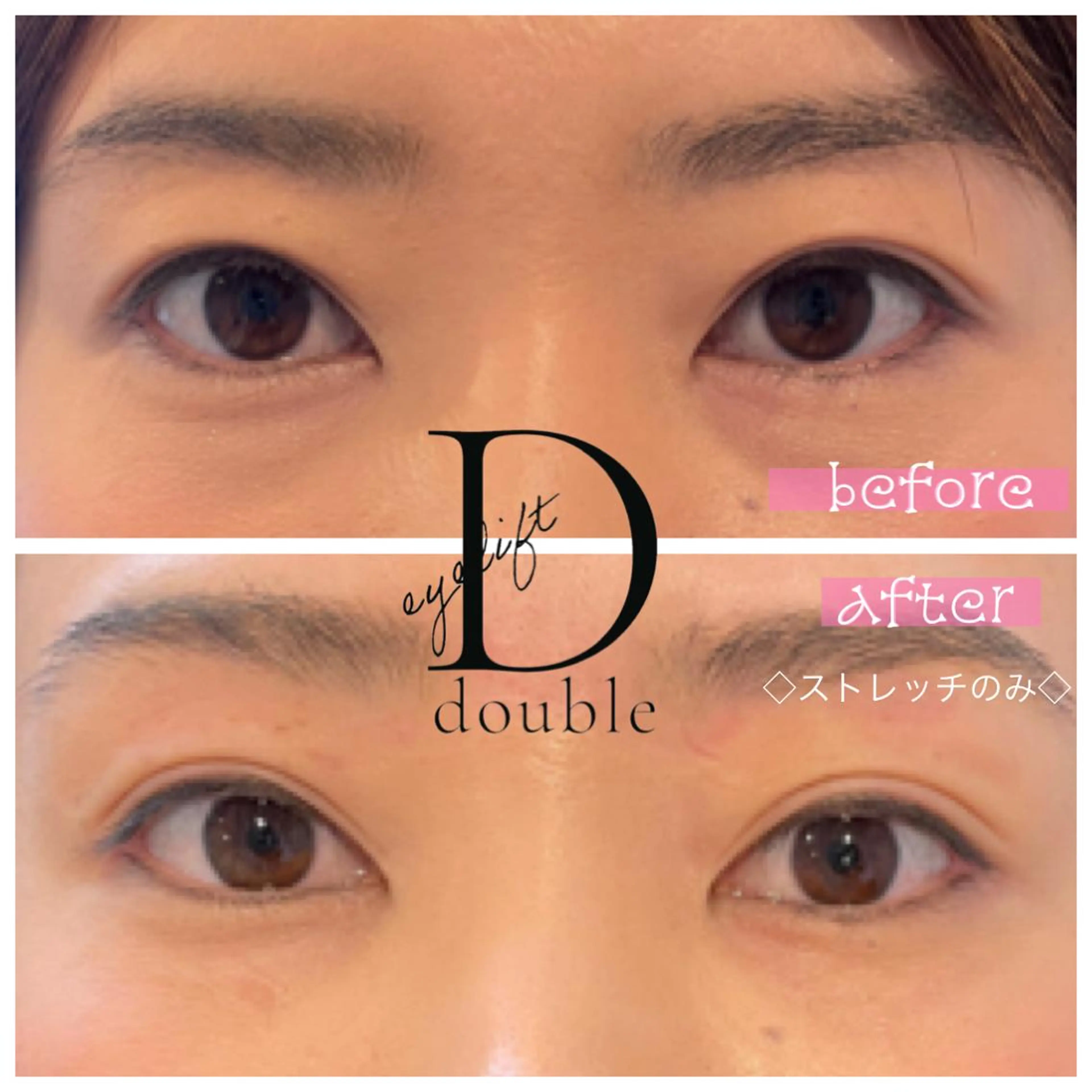 eyelist kのマツエク・マツパデザイン