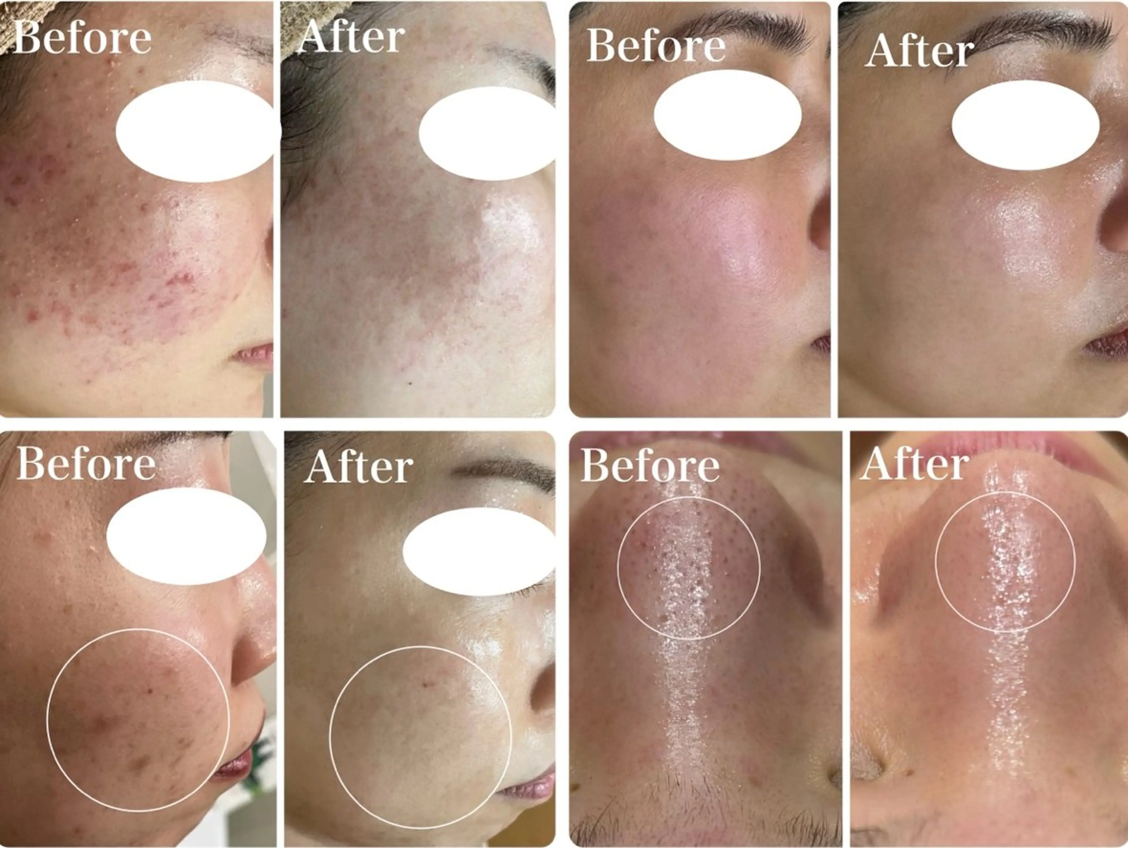 エステ 脱毛&フェイシャル 専門店muro.のエステ・リラクイメージ