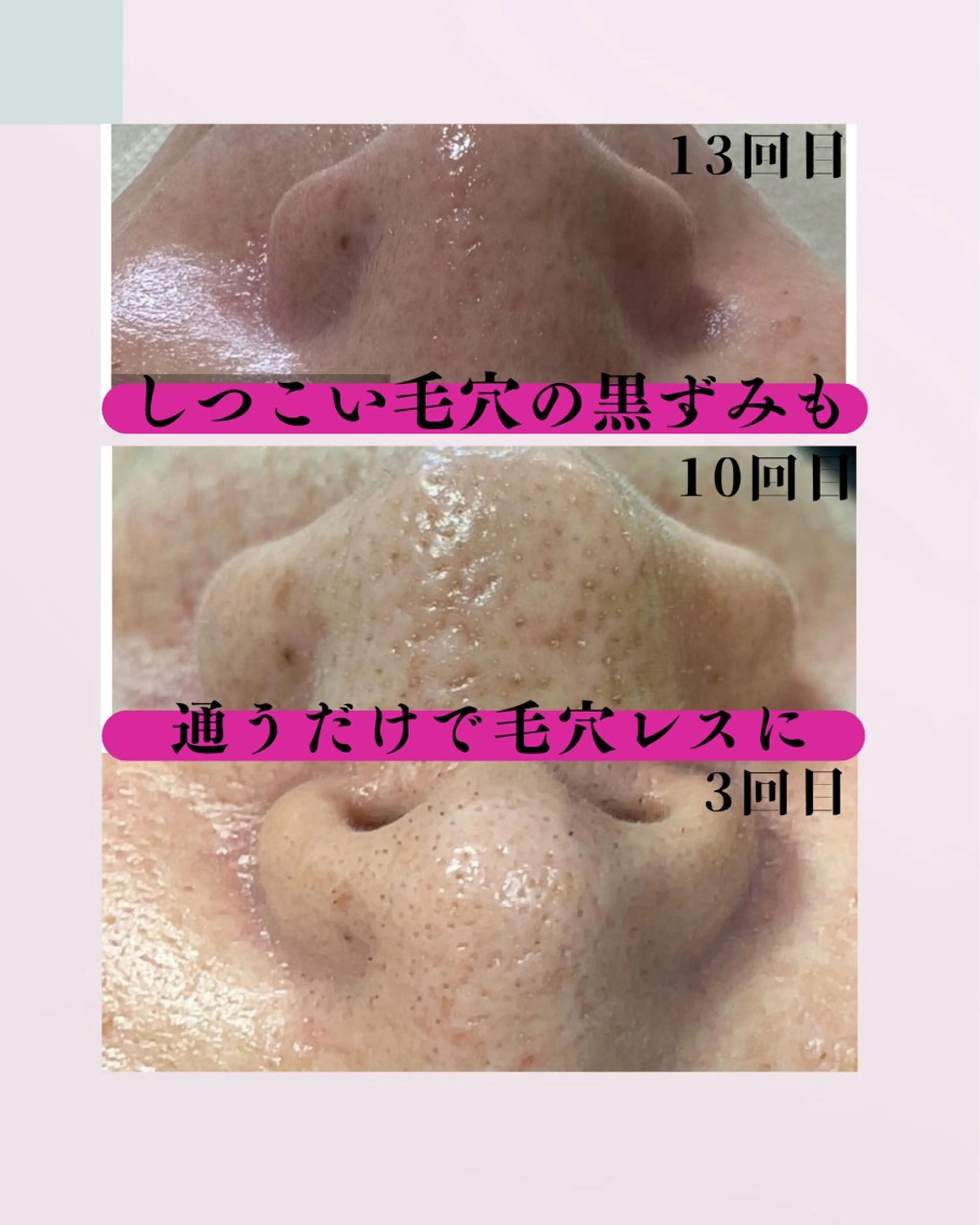 肌質改善サロン facialmoonのエステ・リラクイメージ
