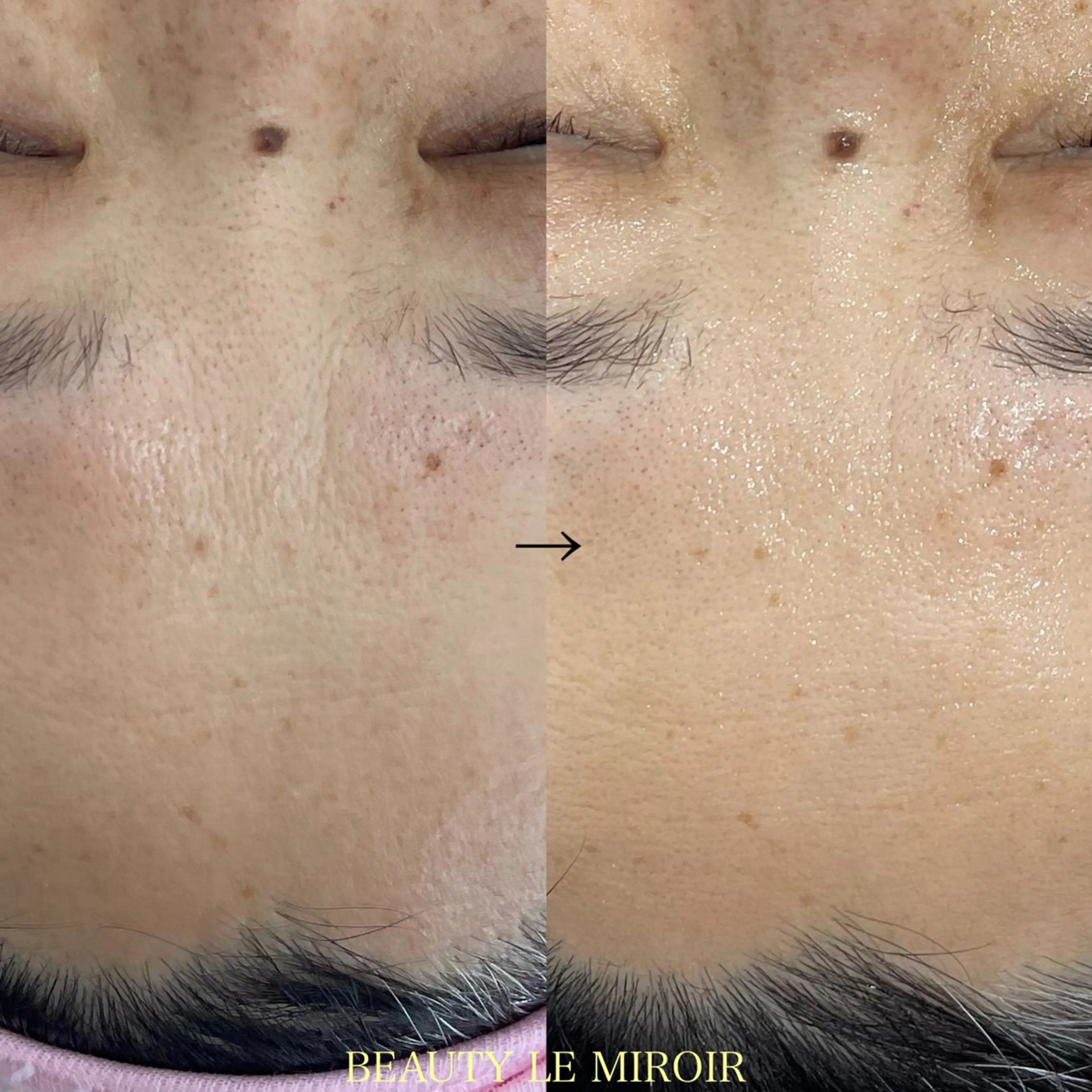 エステ ビューティー ミロワールのエステ・リラクイメージ