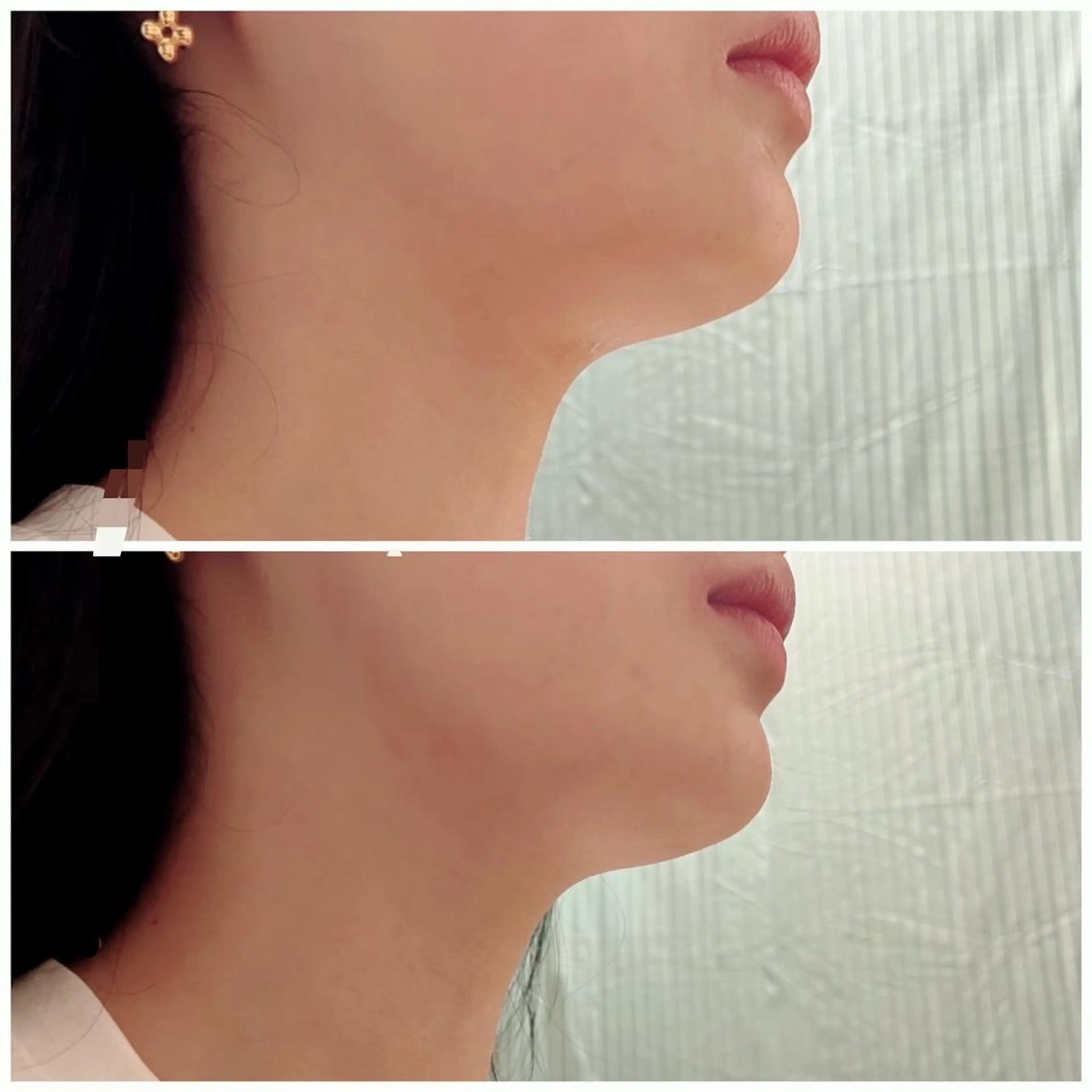 プライベートサロン Lｏｋａｈｉ飯生透のエステ・リラクイメージ