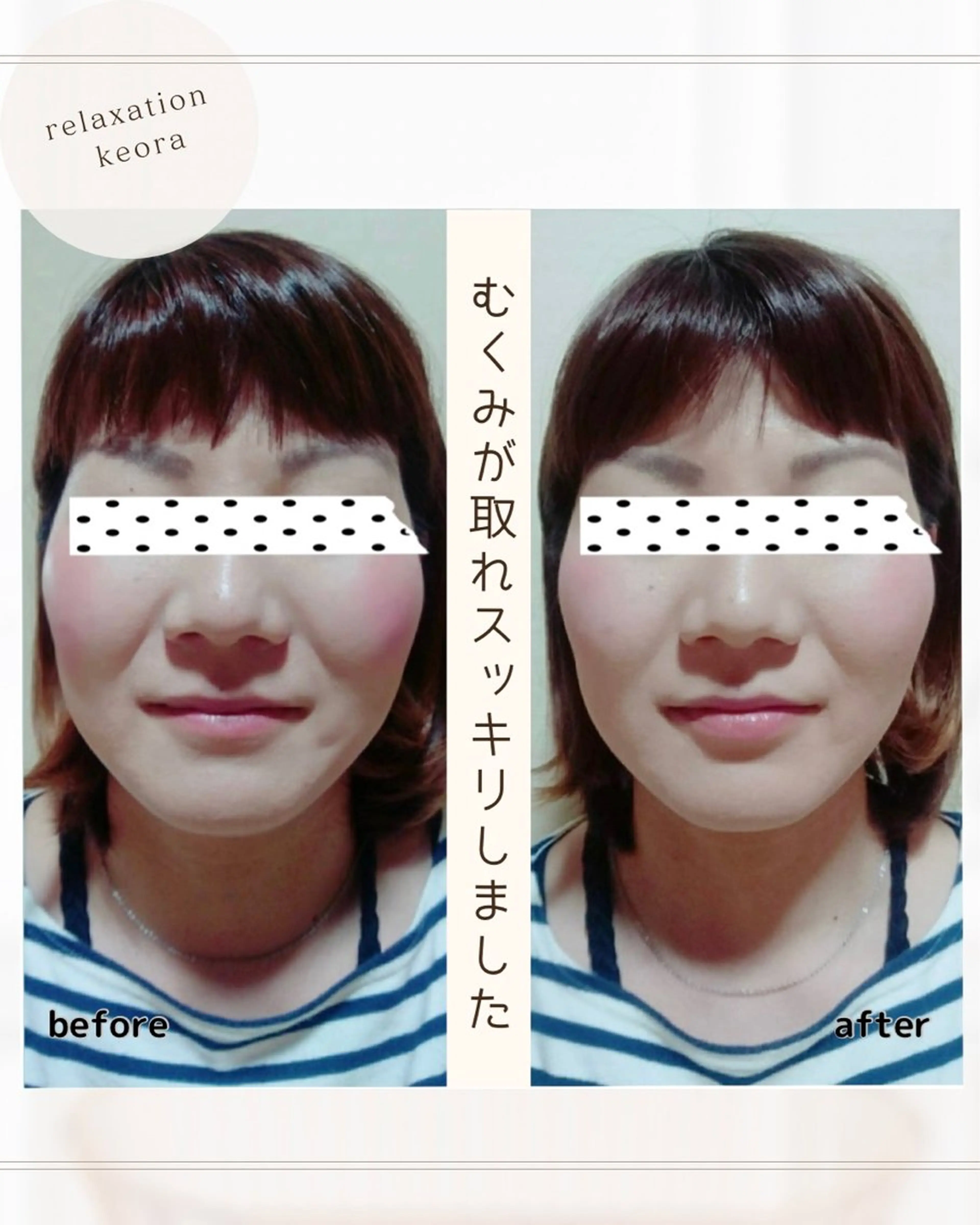 【小顔矯正】 120分の写真