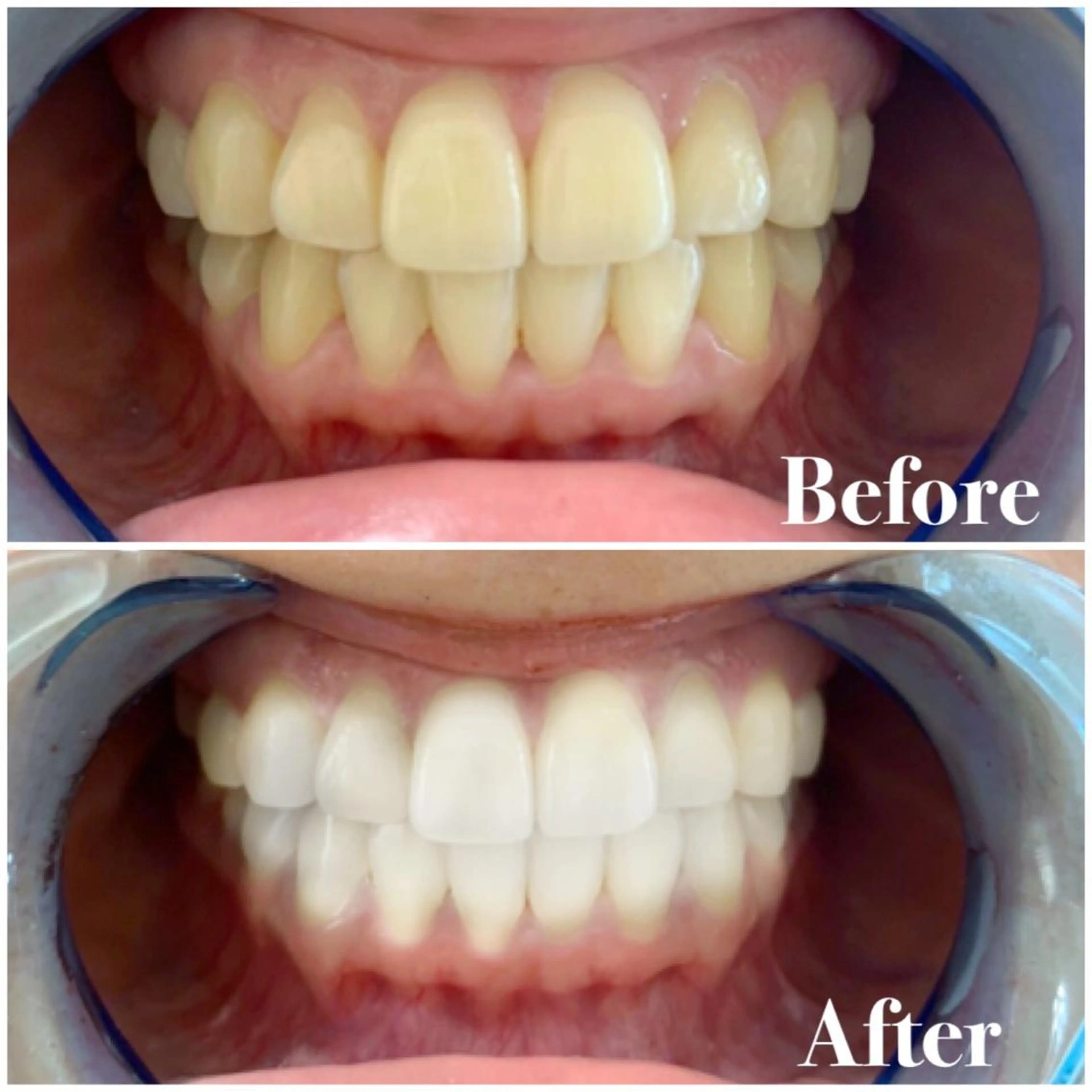 ロング カラー パーマ ヘアアレンジ メンズ キッズ ネイル マツエク・マツパ ライトビューティー 錦糸町店のエステ・リラクイメージ