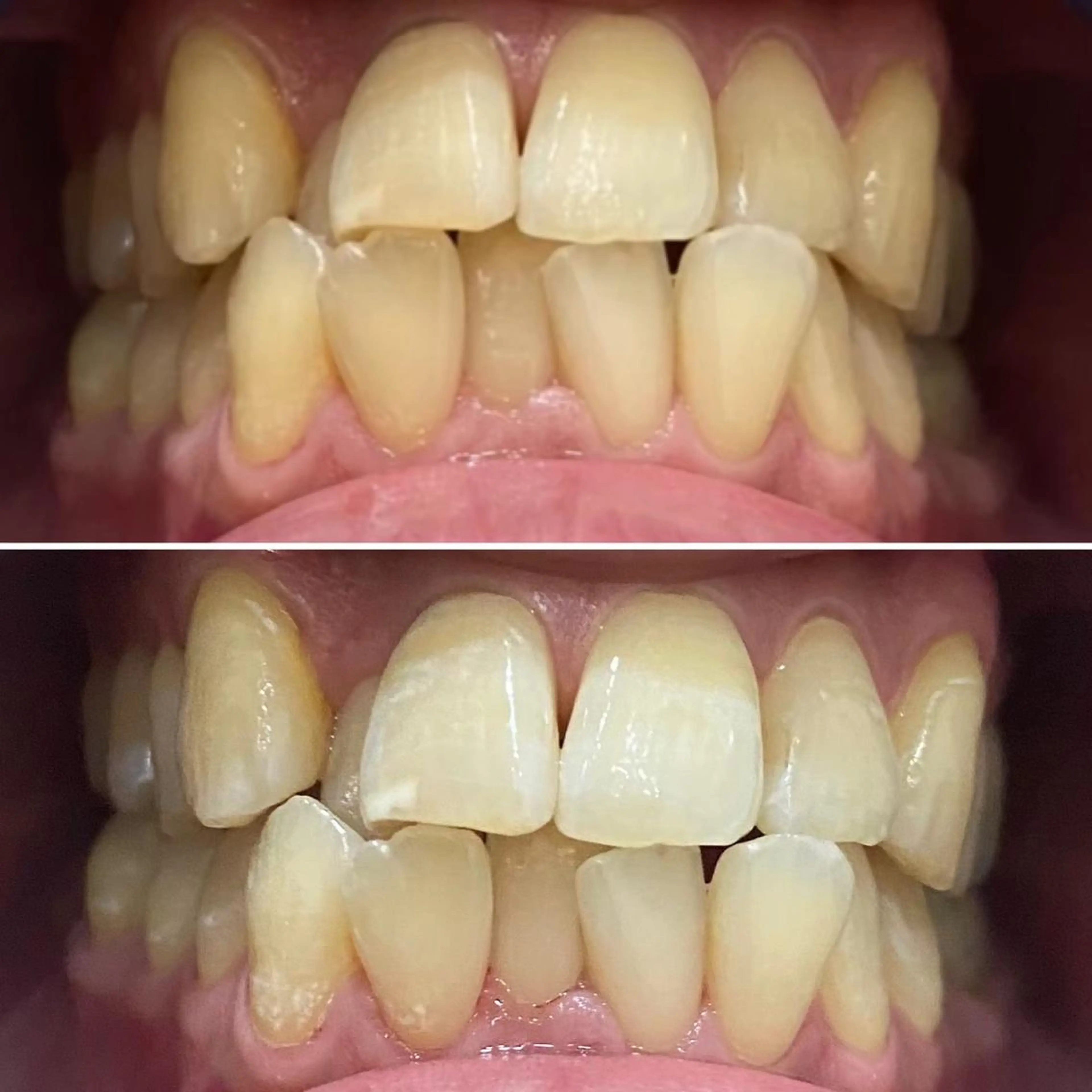 メンズ その他 whiteclub.THREE福島店所属・whiteclub THREEのその他イメージ