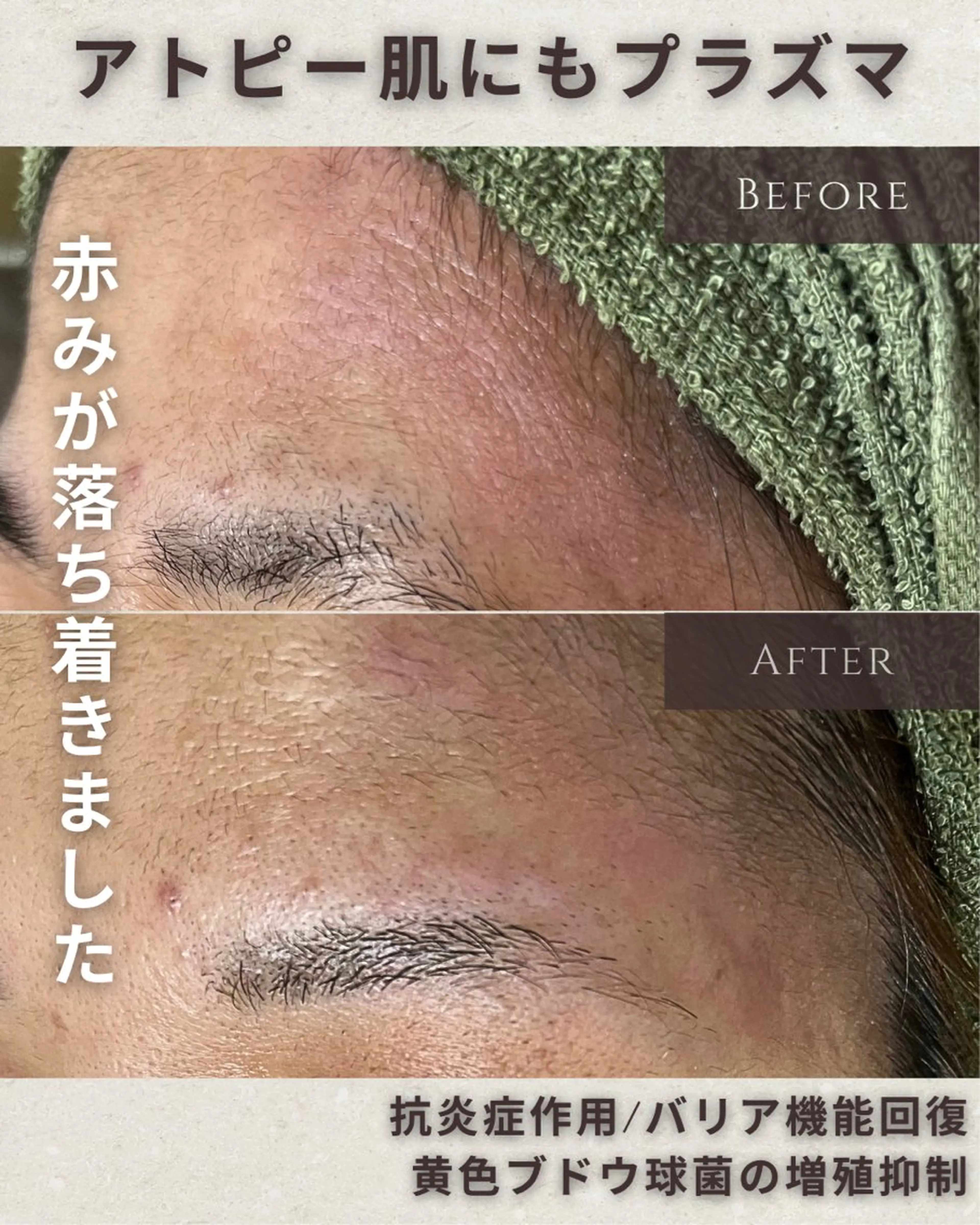 エステ シミ毛穴|眉Wax THE  flowのエステ・リラクイメージ