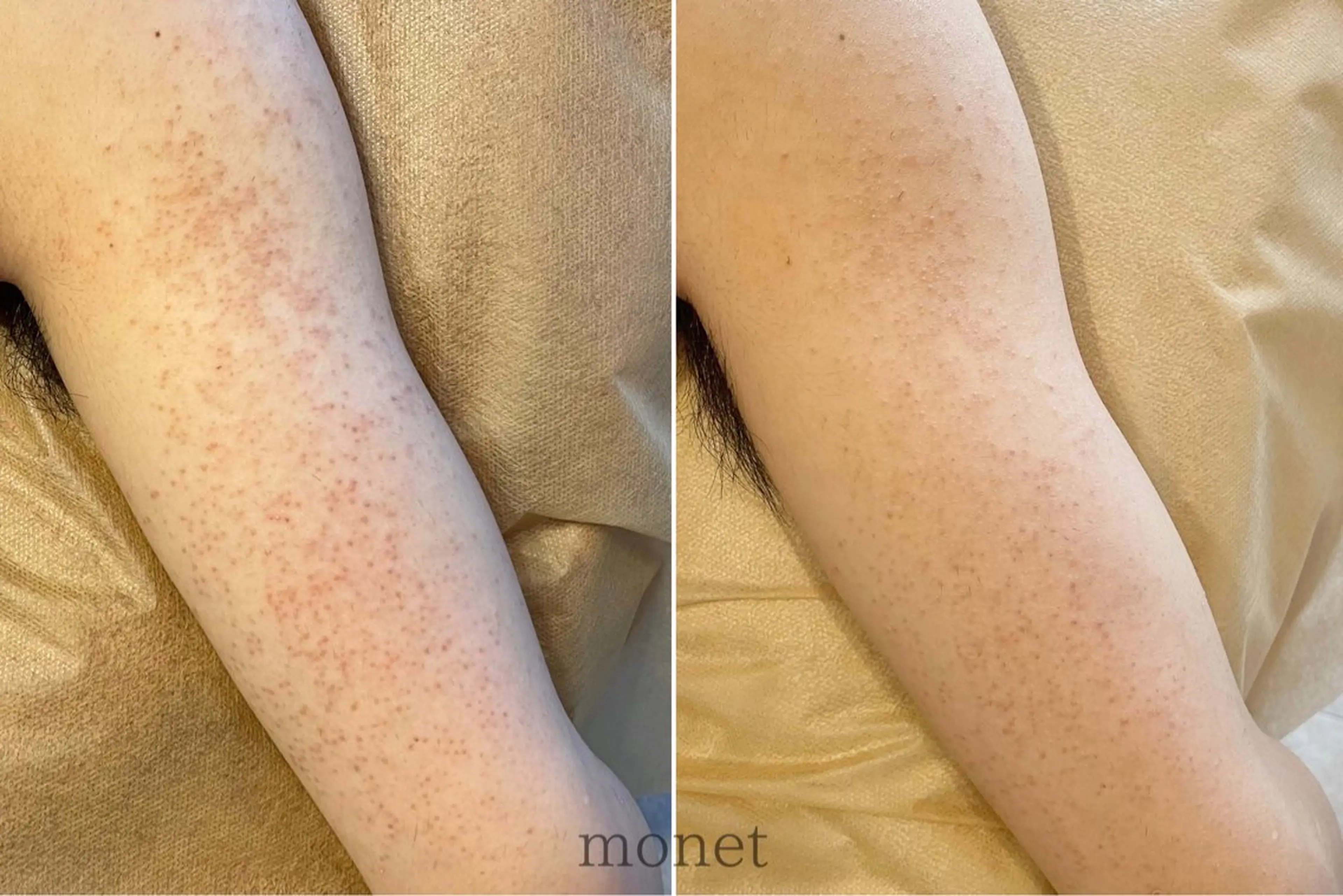 肌質改善🌿 彩也乃のエステ・リラクイメージ