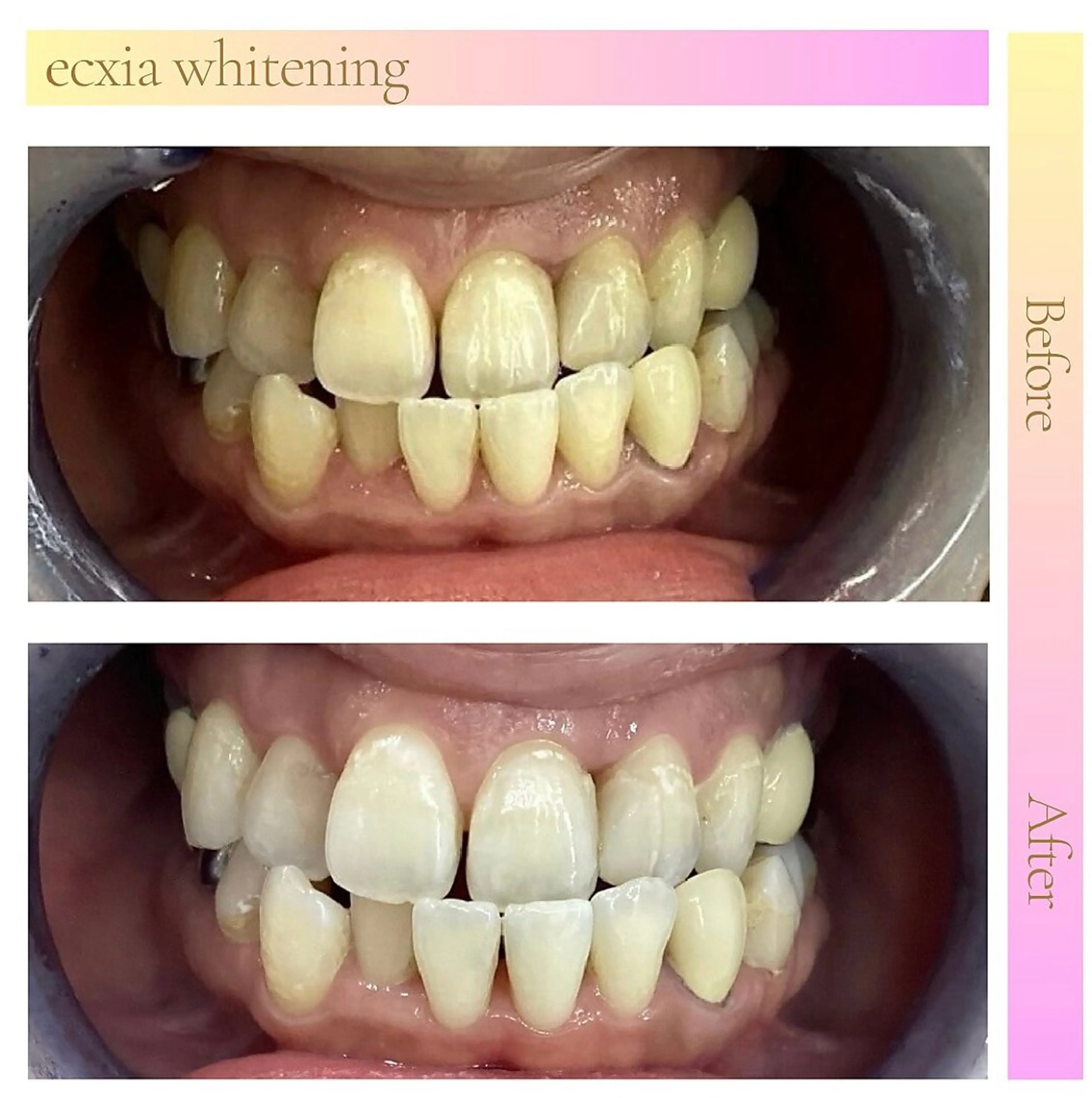 エクシアホワイト長野店所属・セルフホワイトニング エクシア長野店のその他イメージ