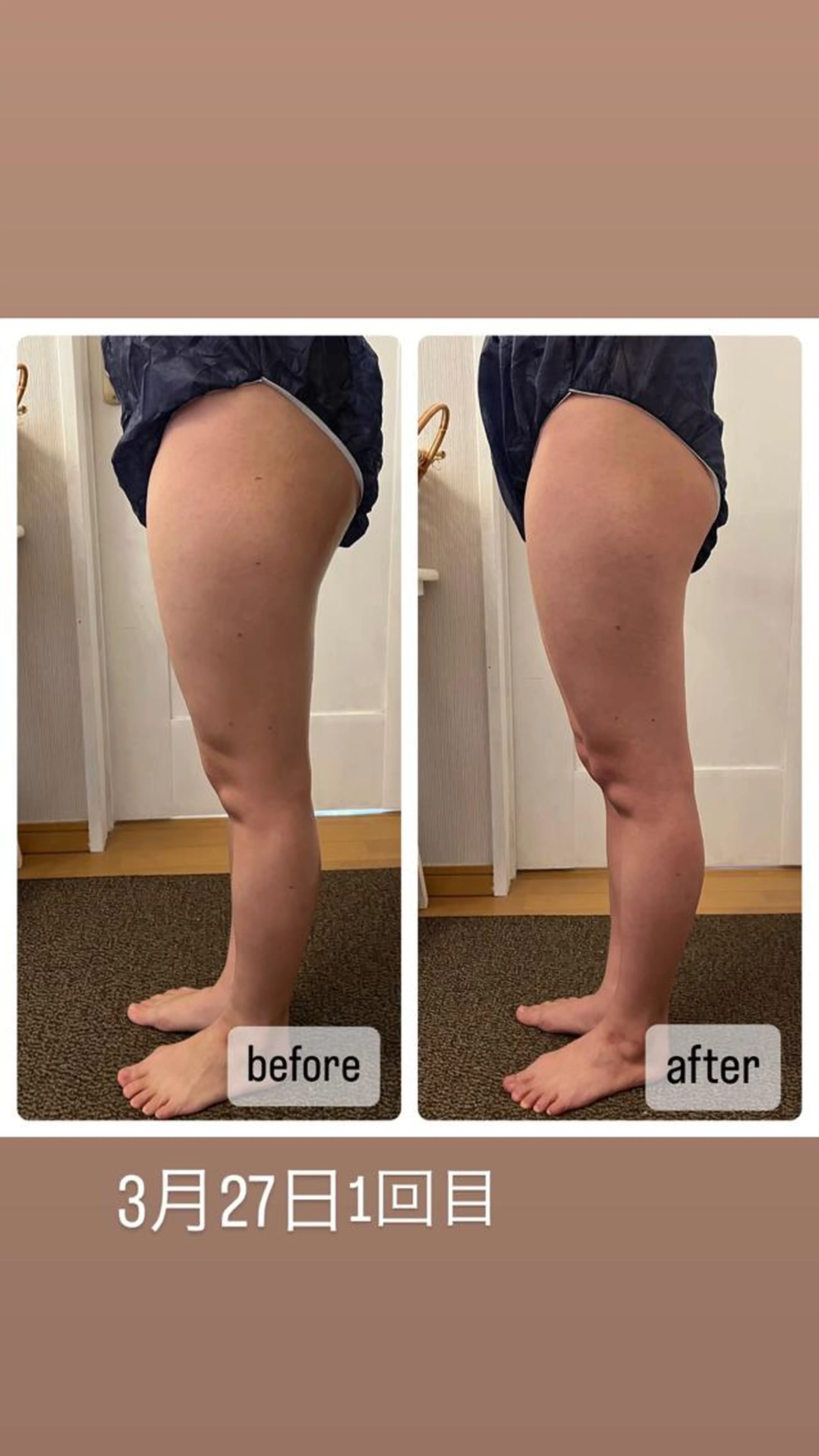 スッキリさせたい方必見‼️痩せたい部分に集中お腹or背中or太ももor二の腕からお選びください✨の写真